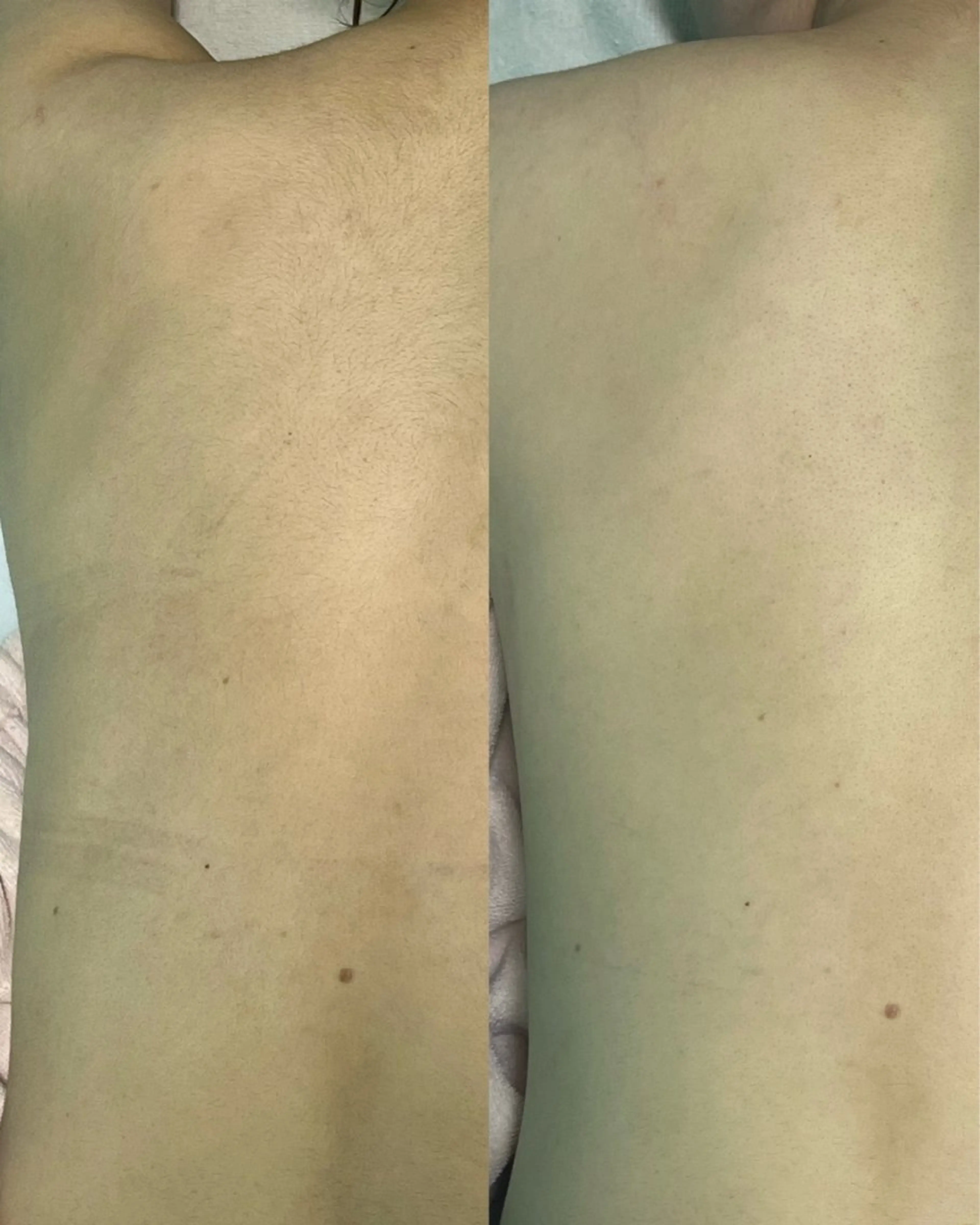 脱毛 y2k SALONのエステ・リラクイメージ