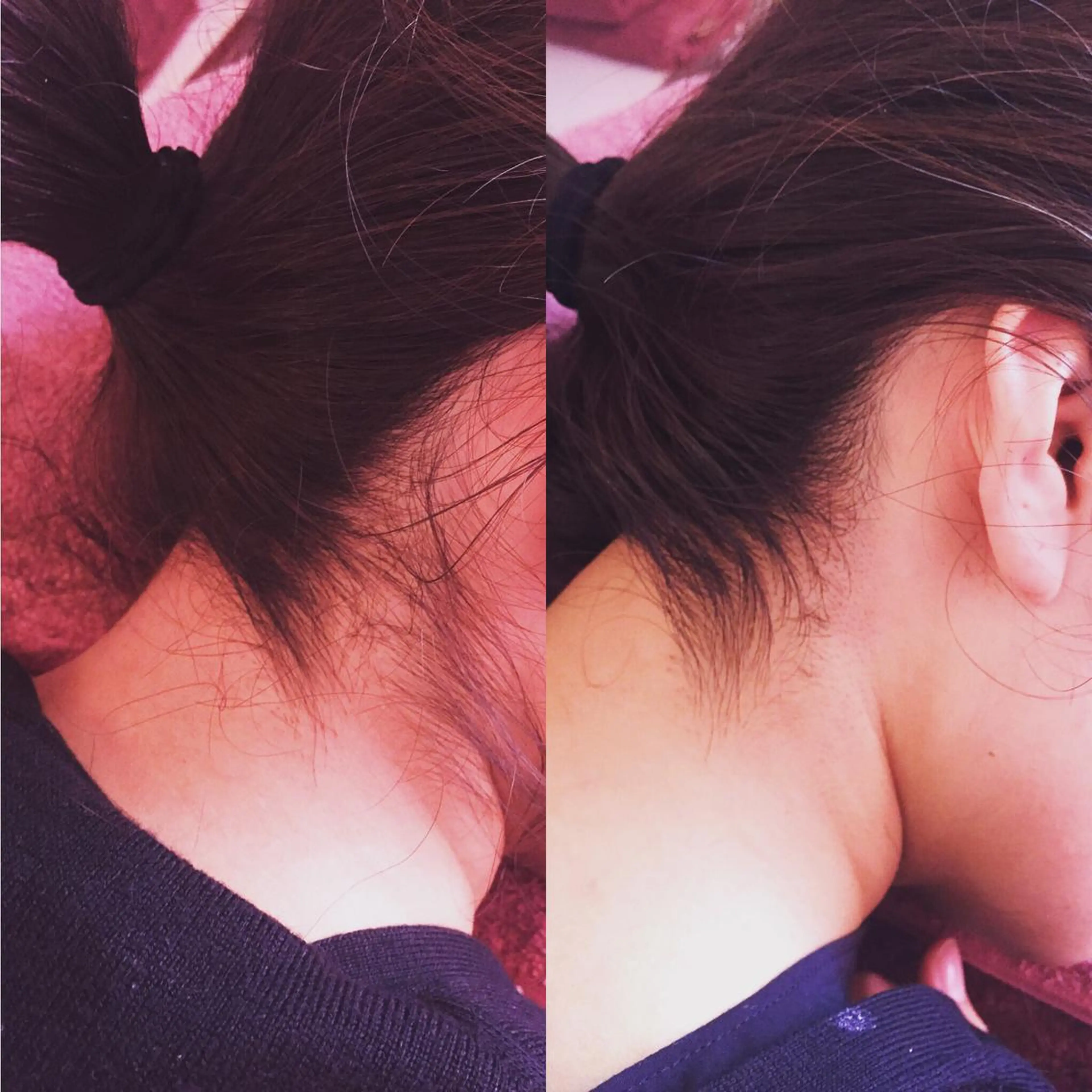 都度払い脱毛(膝上、膝下、お尻他大きなパーツもあり)
脇、襟足は3200円
詳しくは下記補足説明よりご覧下さいの写真