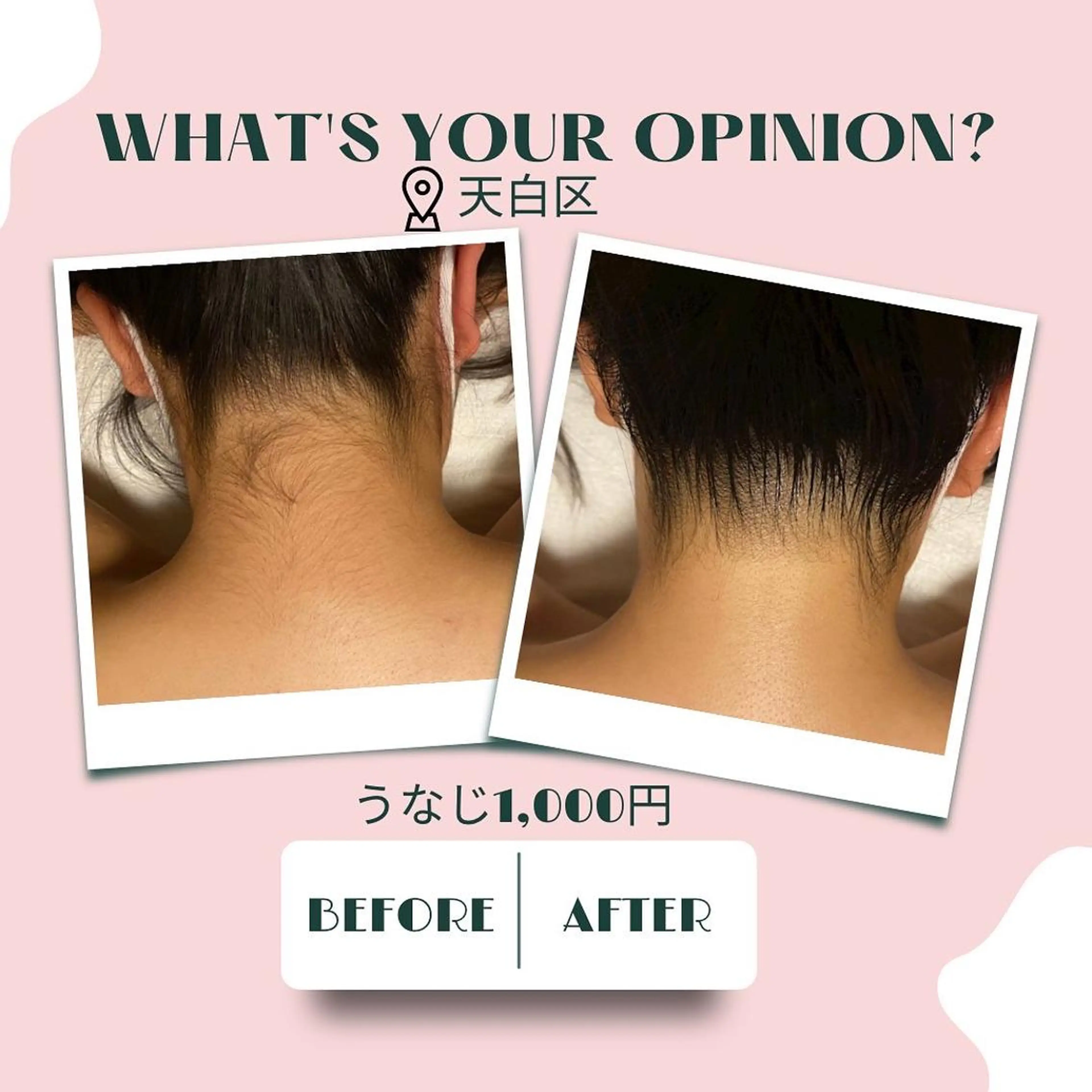 キッズ 脱毛 🌈松 本🌈のエステ・リラクイメージ