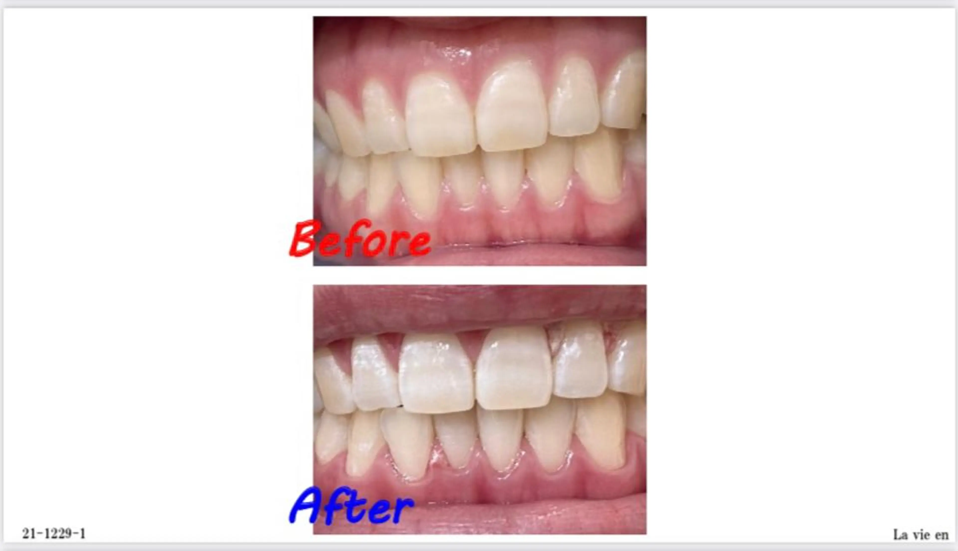 その他 セルフホワイトニングサロン　ラヴィアン所属・ホワイトニングサロン La vie enのその他イメージ