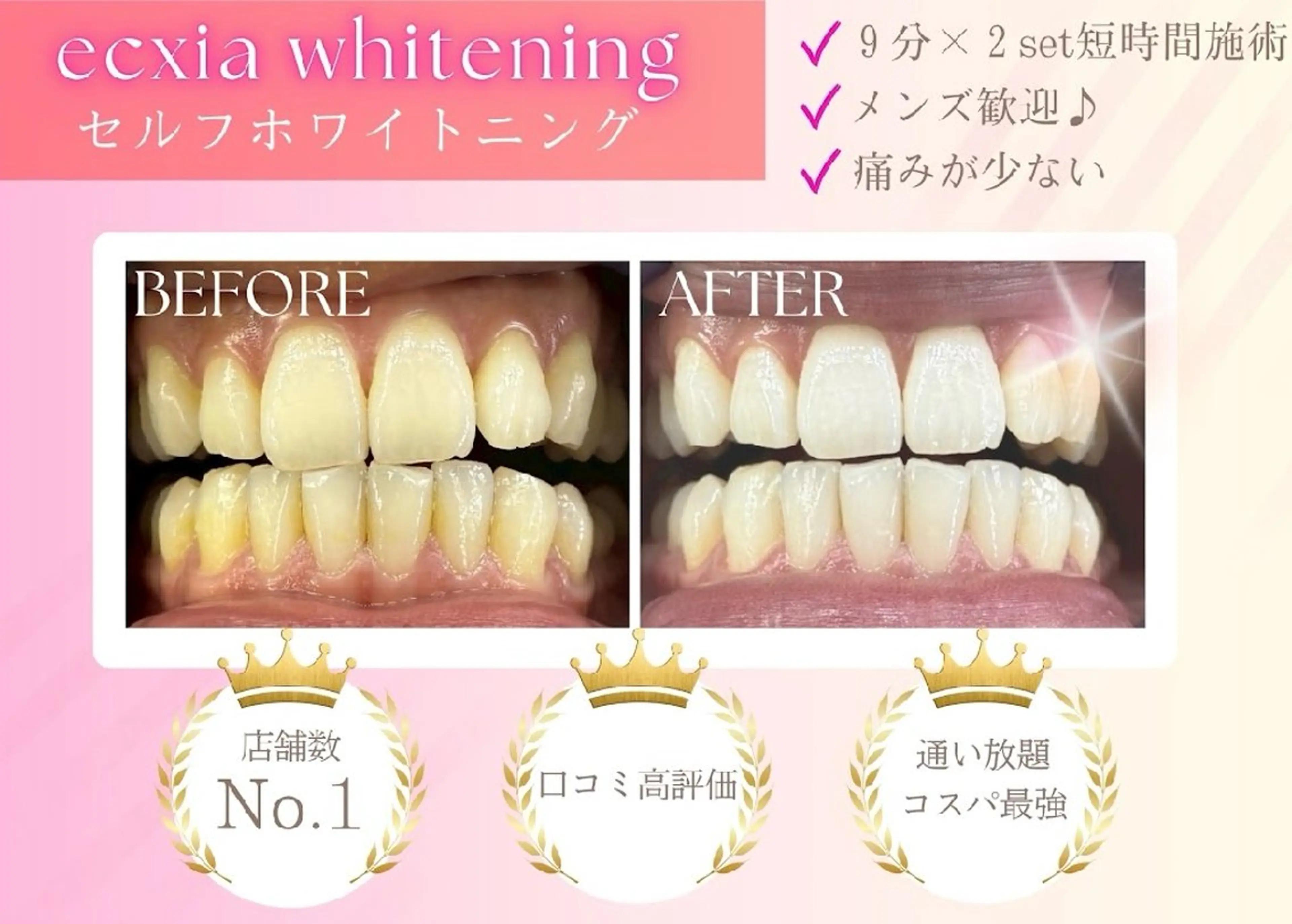 エクシアホワイト 秋田大町店　杉山のその他イメージ