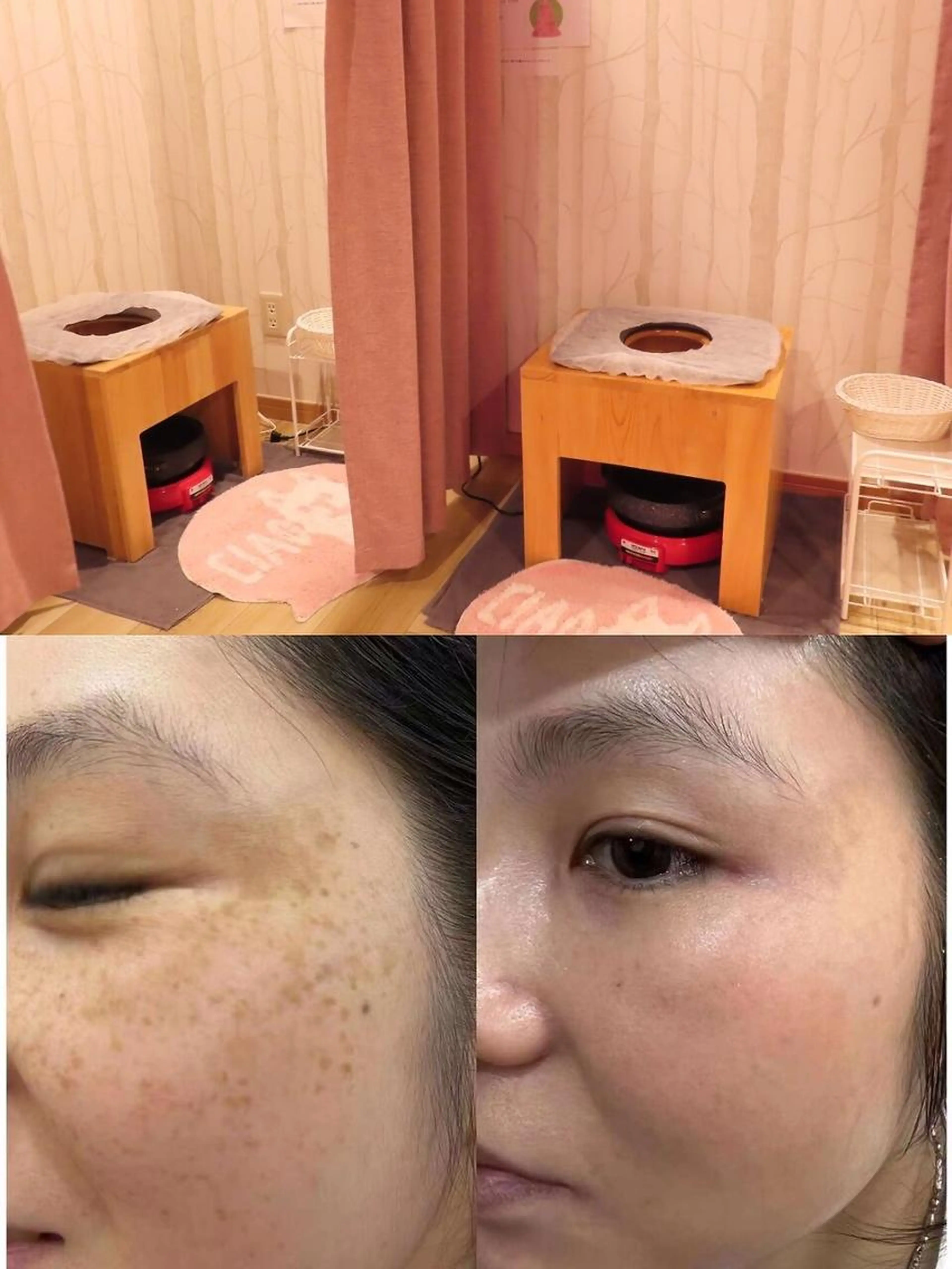 【血行促進】大人気よもぎ蒸し+光フェイシャル80分の写真