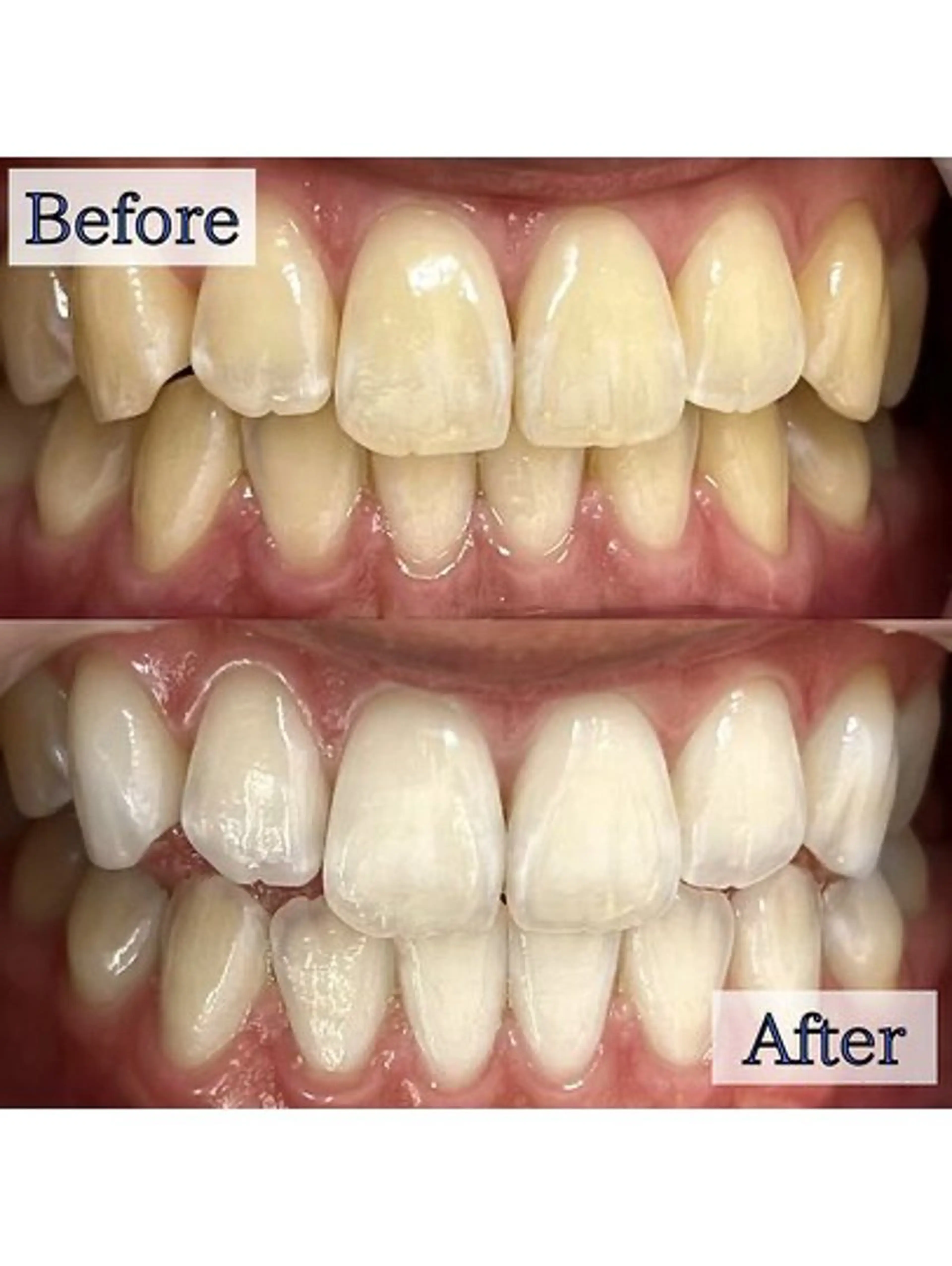 エステ リラク LBSホワイトニング 🌐 上野店公式のエステ・リラクイメージ