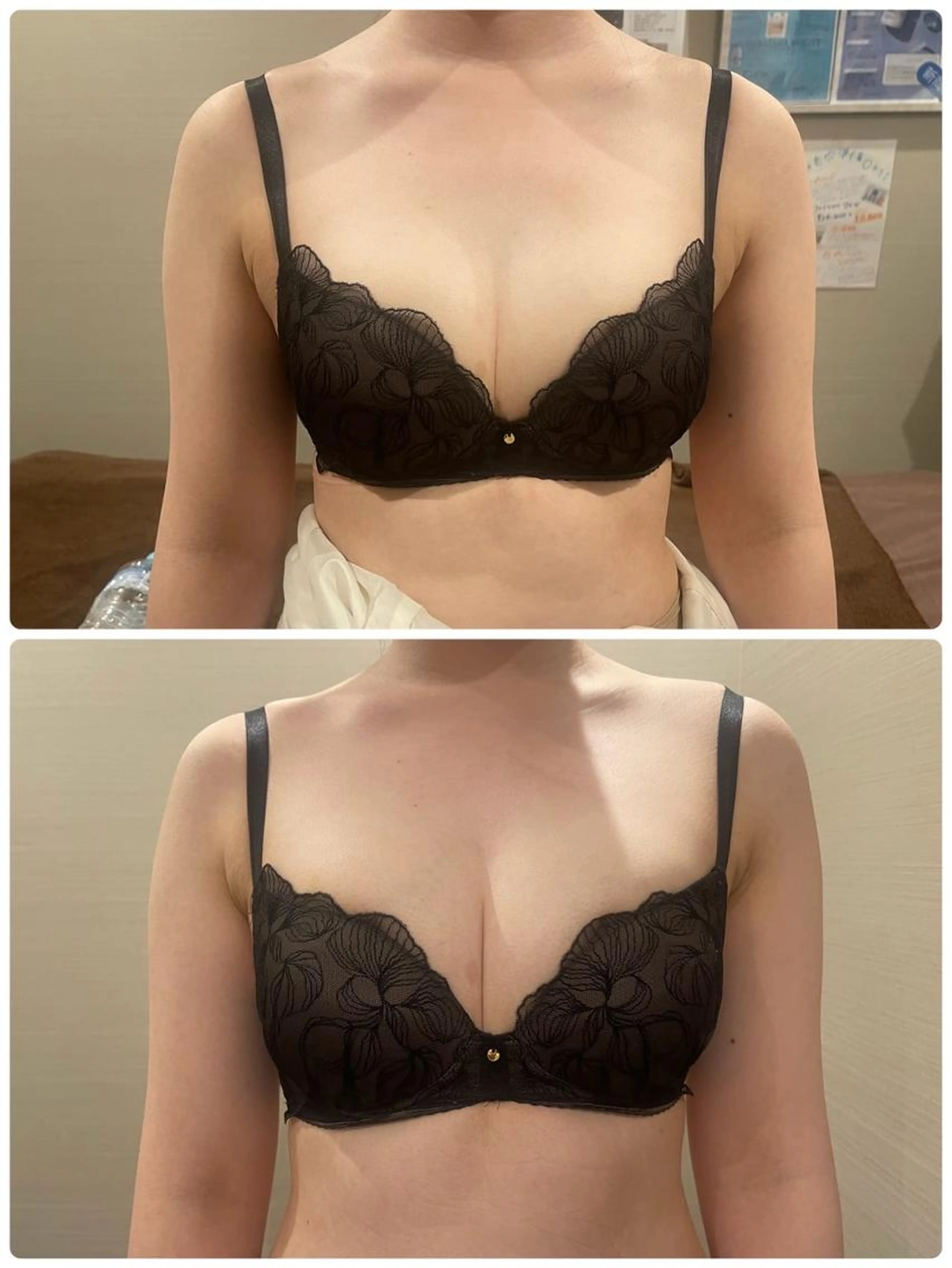 人気no1!圧倒的美乳へ!バスト✖︎肩こり二の腕背中脇肉巻き方ケア美人目指しましょう❕の写真