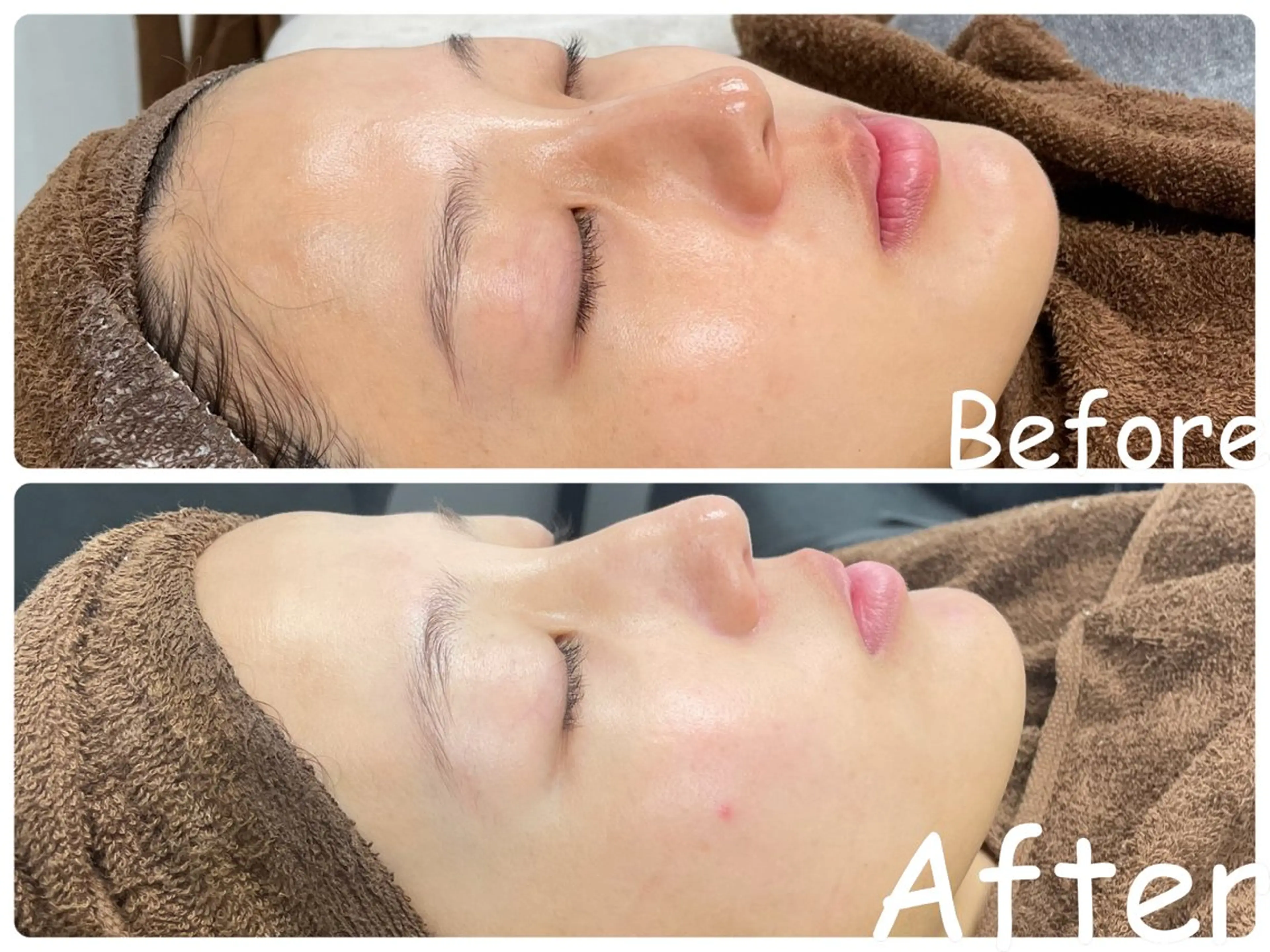 エステ リラク ele"ハーブ ピーリング 専門店のエステ・リラクイメージ