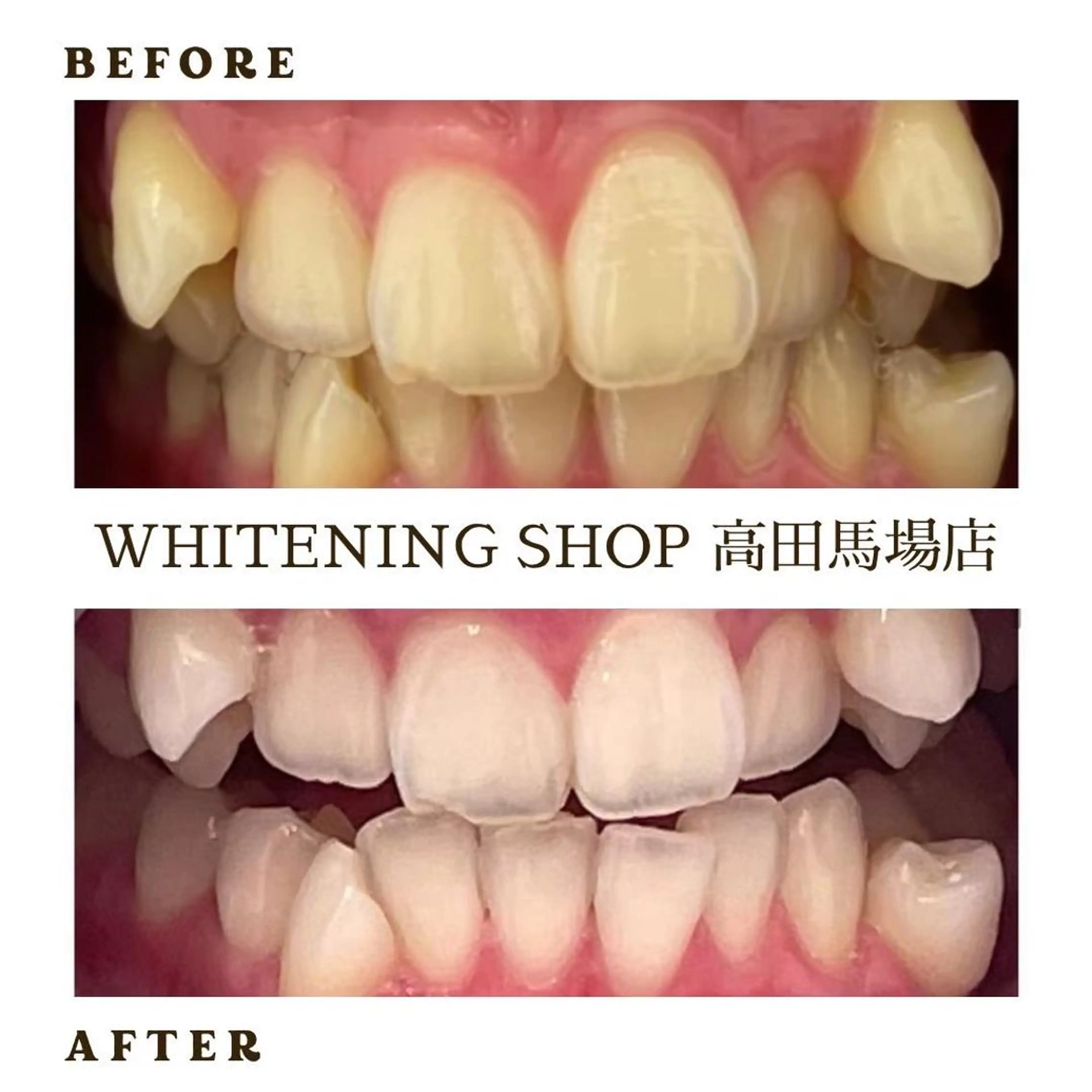 メンズ その他 ホワイトニング ショップ高田馬場店のその他イメージ
