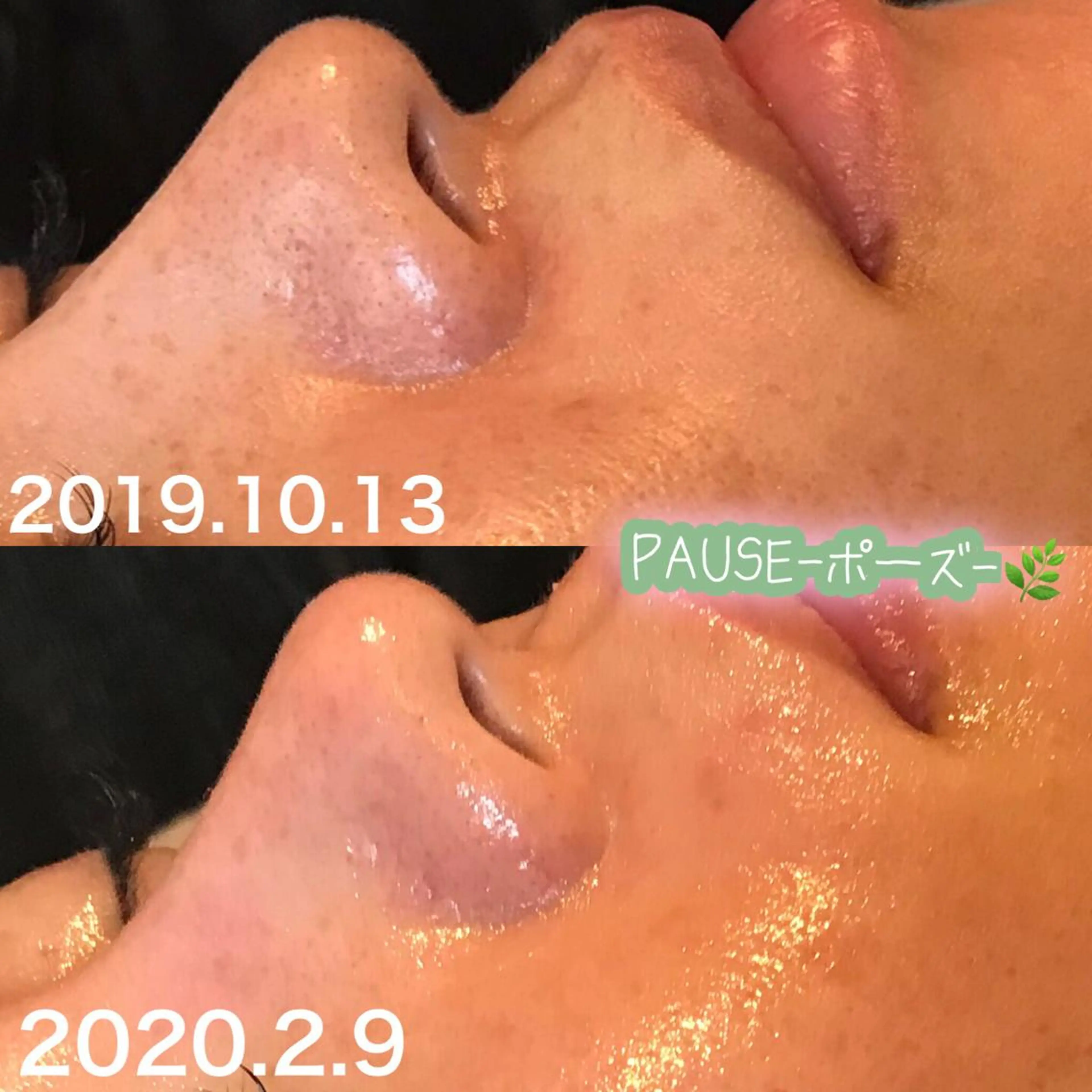 エステ 浜野 恵美のエステ・リラクイメージ