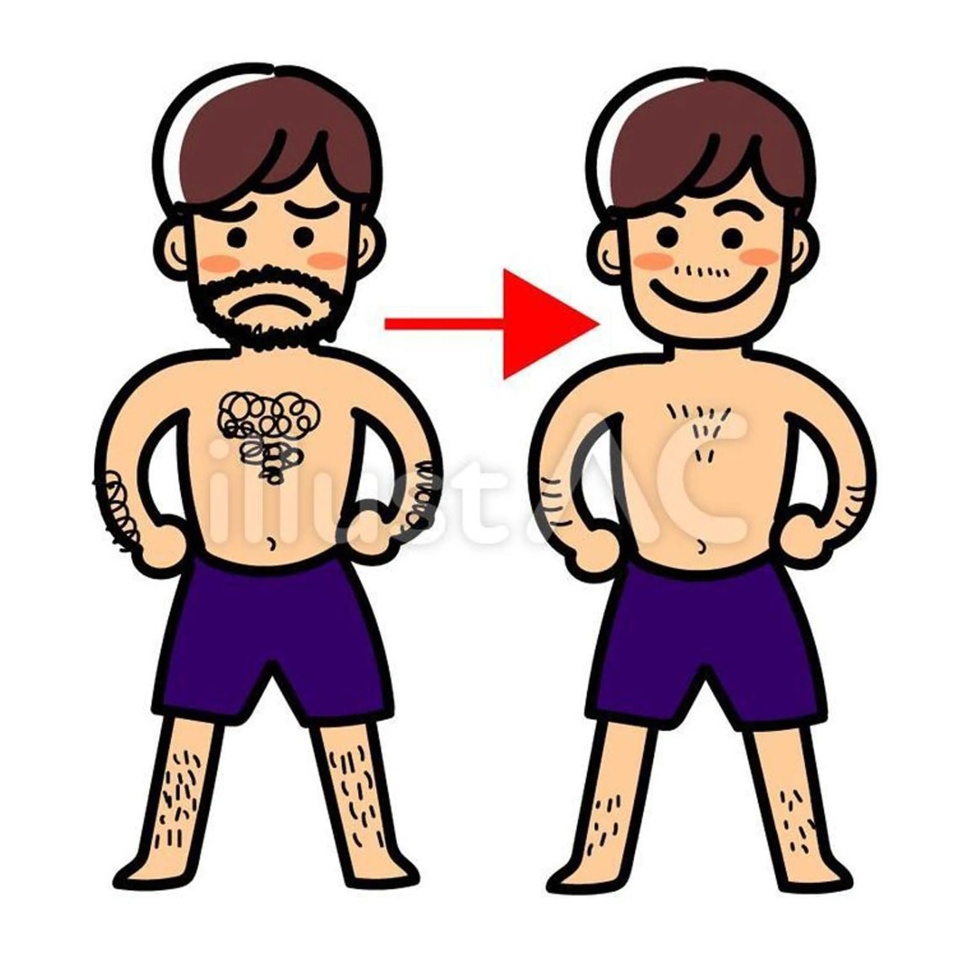 脱毛 アンジェリカ 脱毛店のエステ・リラクイメージ