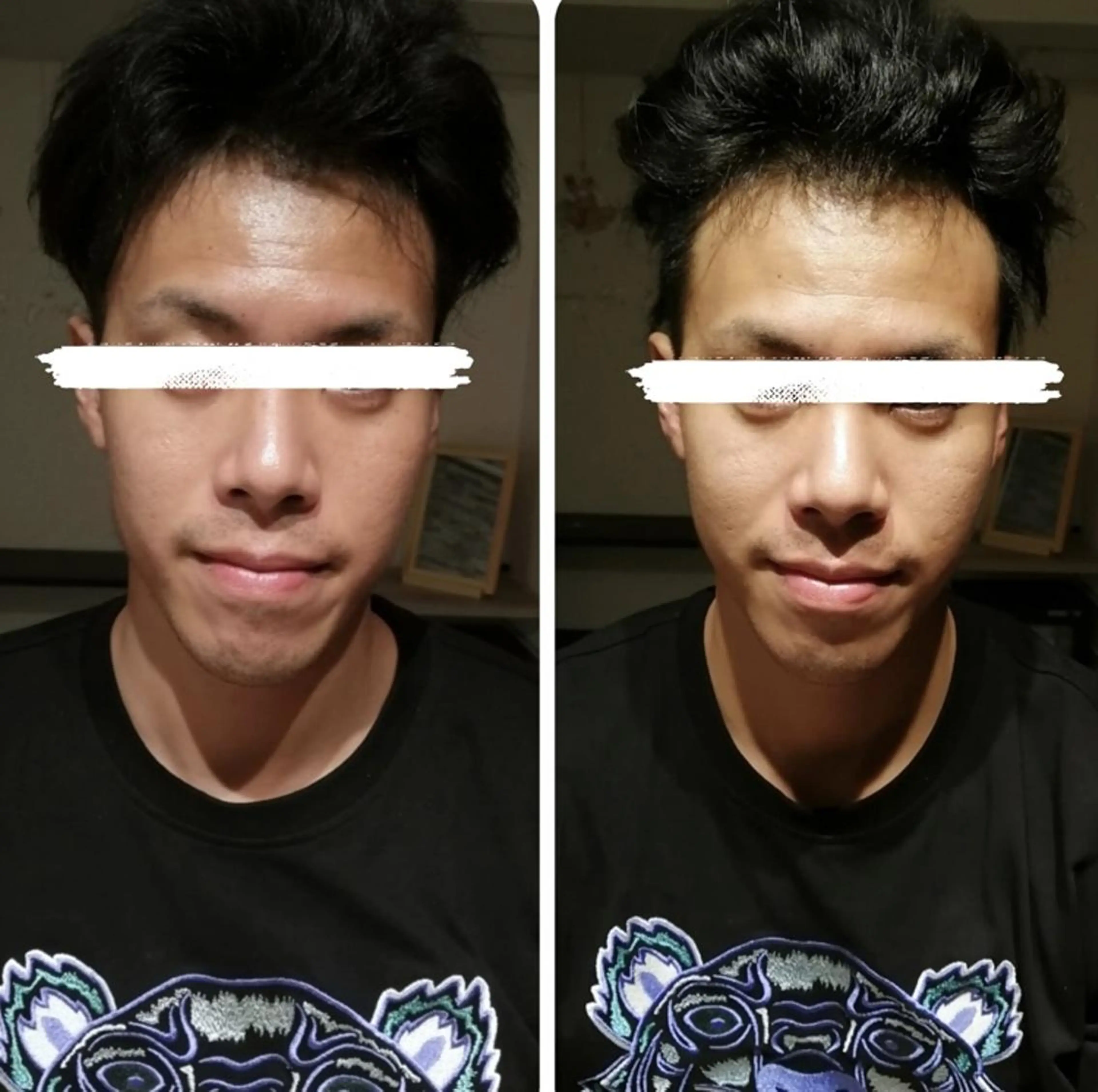 新規男性限定⭐️プロの高専門技術✨メンズ/モデル/左右差/イベント前にも❗️【小顔矯正+首肩矯正+頭蓋骨矯正】60分の写真
