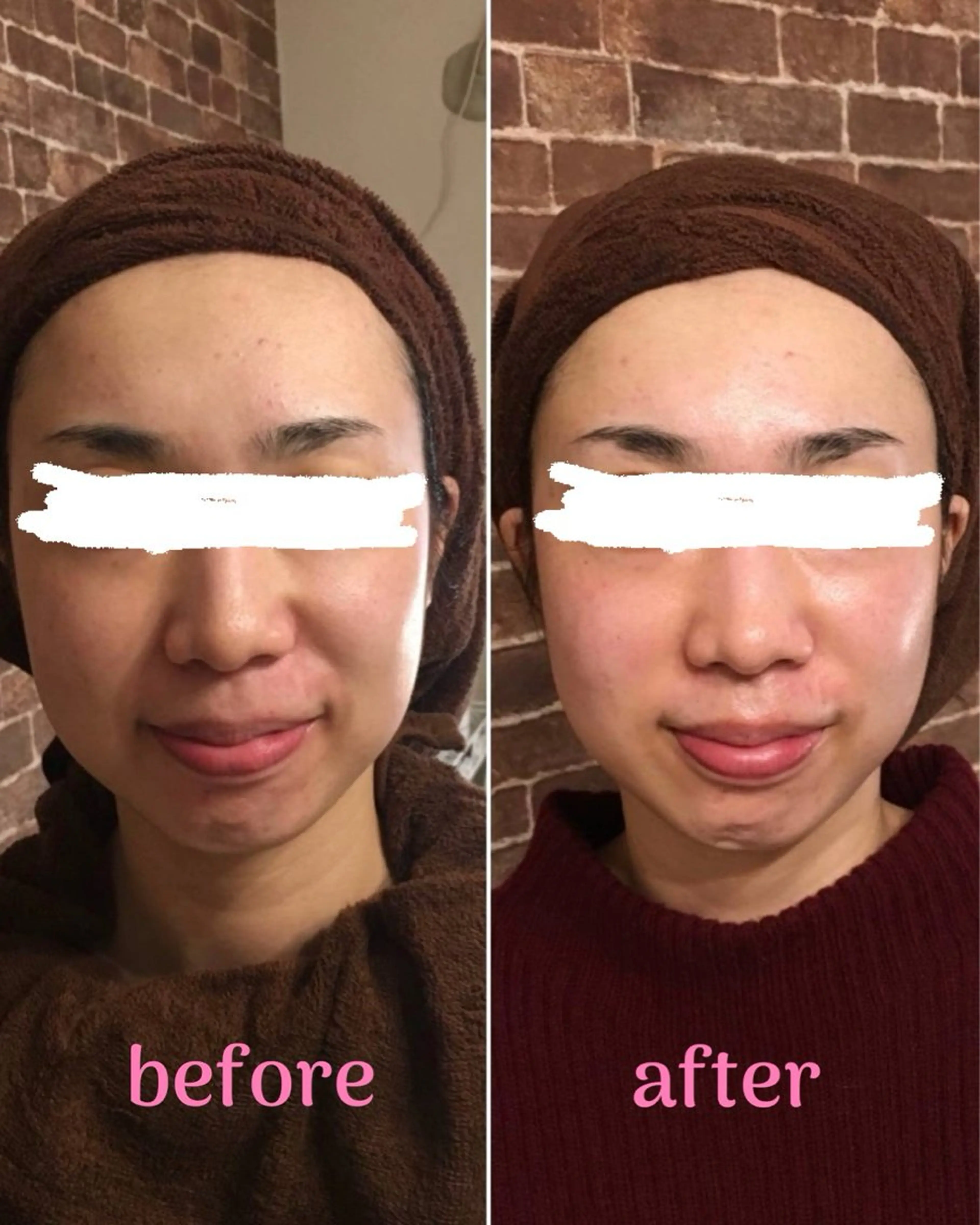 🌞シミケアサロン @SUNiko🌴のエステ・リラクイメージ