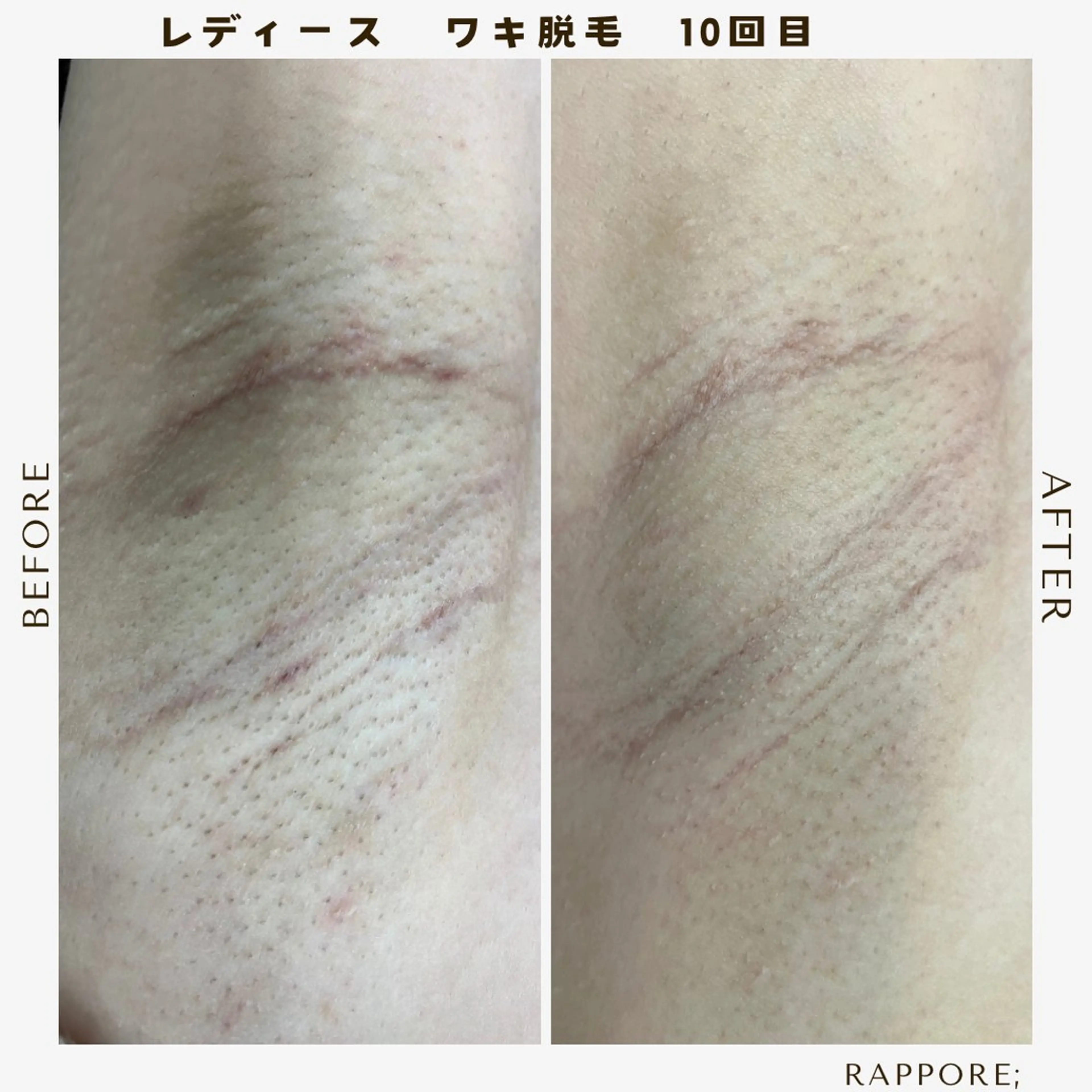 Rappore; 心斎橋　みずきのエステ・リラクイメージ