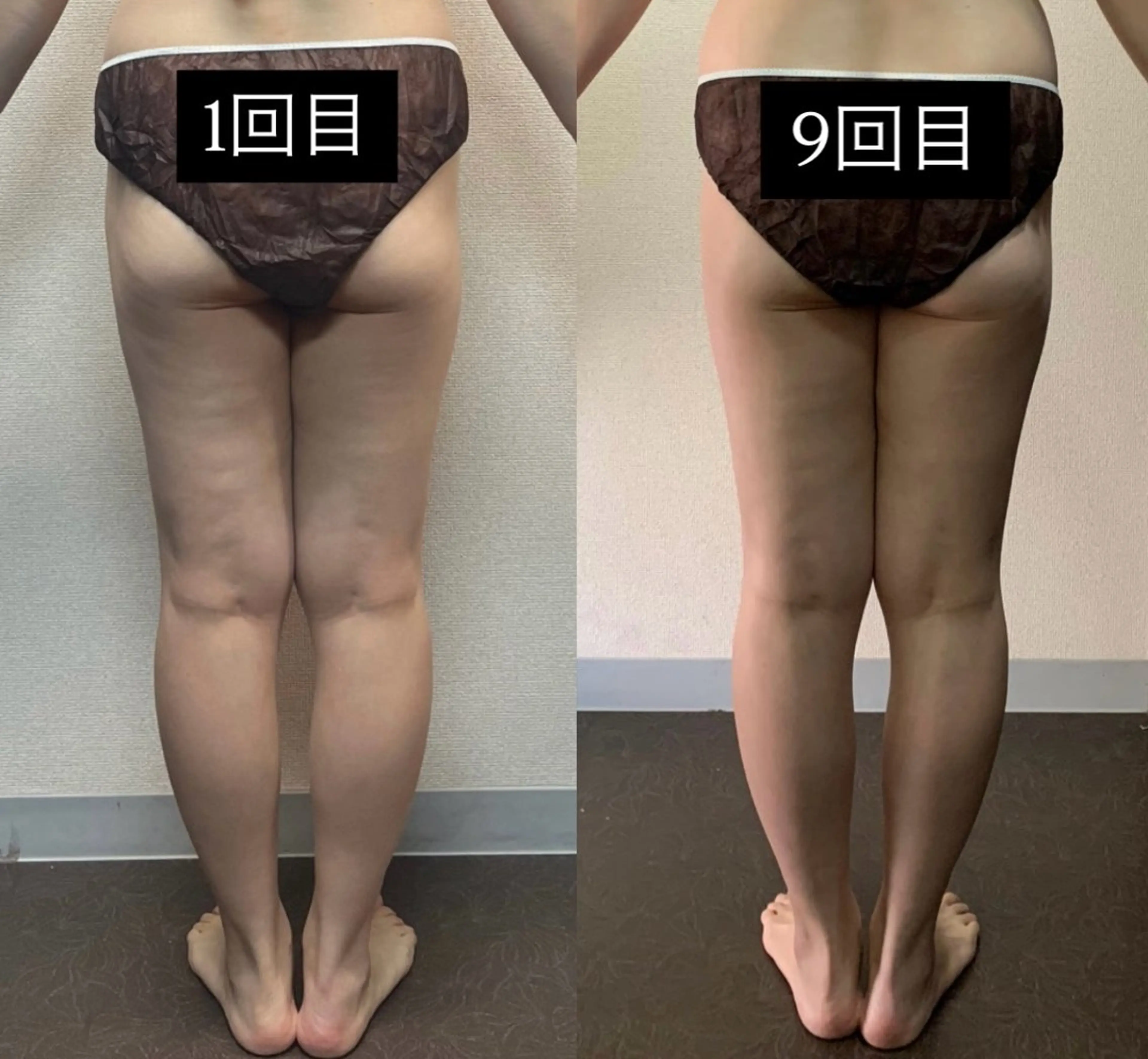 ハイパーナイフ専門店　Salon de COCO所属・Salon de COCOのエステ・リラクイメージ