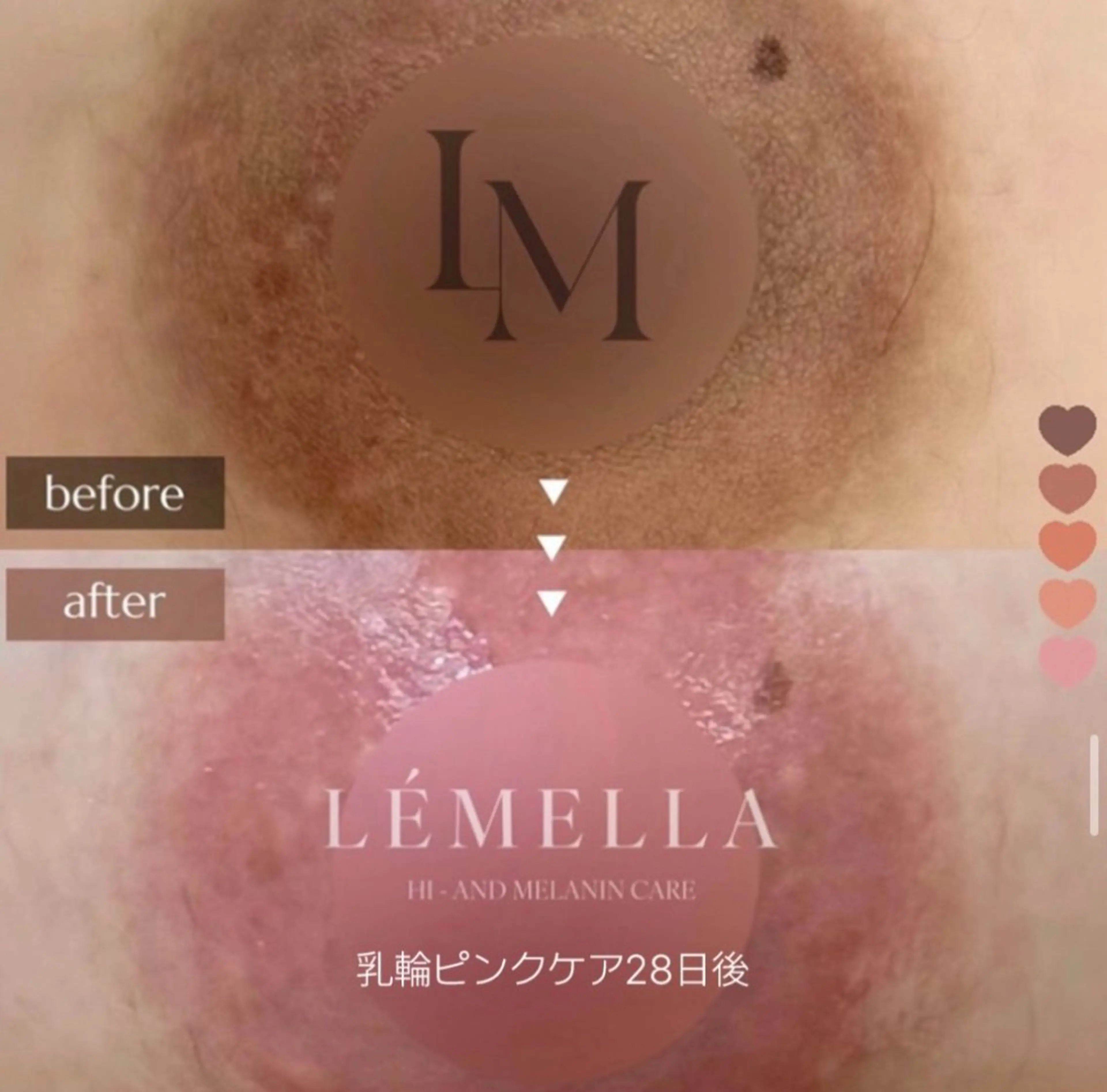 【5月6日限定】今話題のルメラ🩷バストトップマッサージ付きの写真