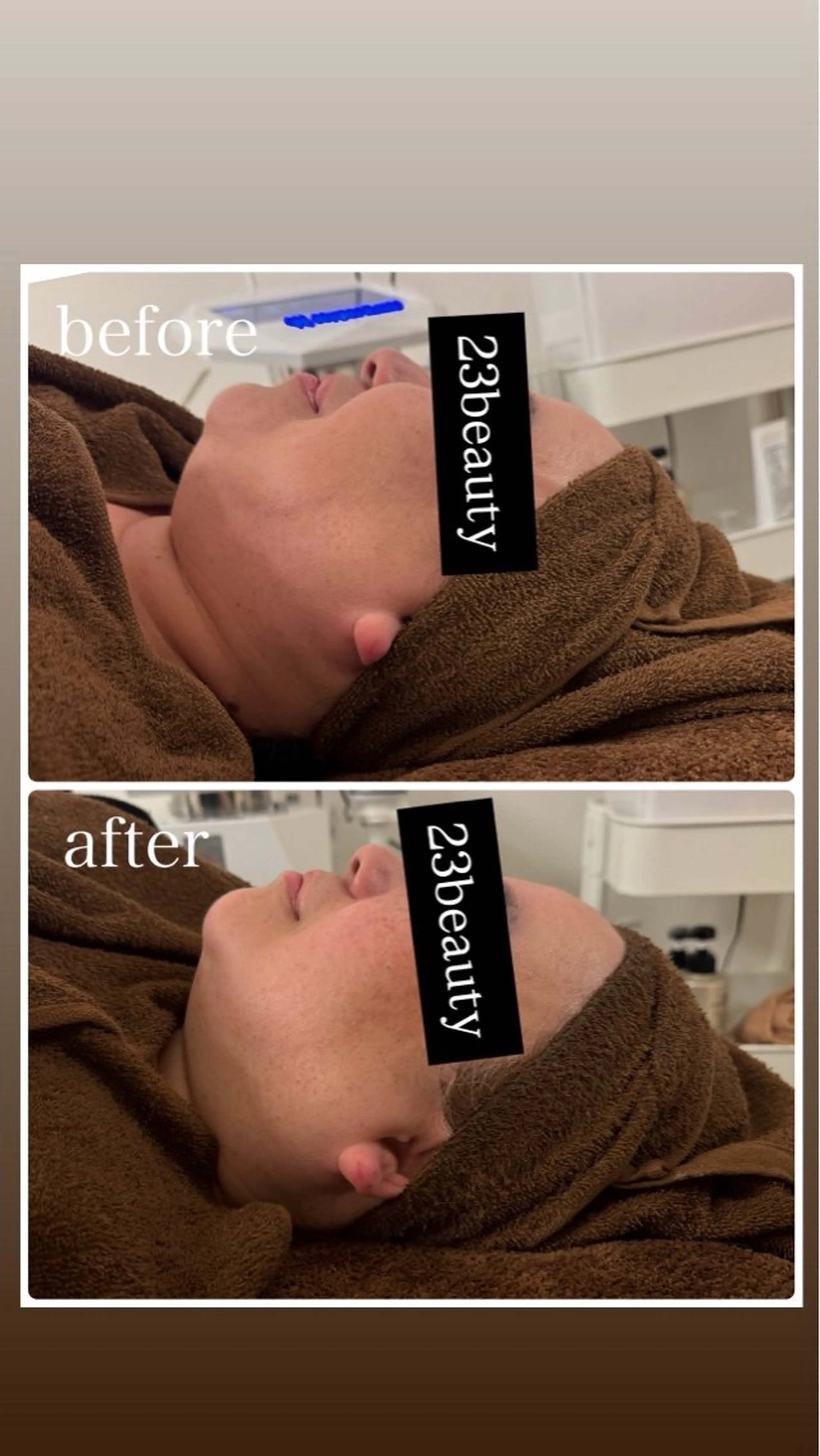 エステ 武藤 那月のエステ・リラクイメージ