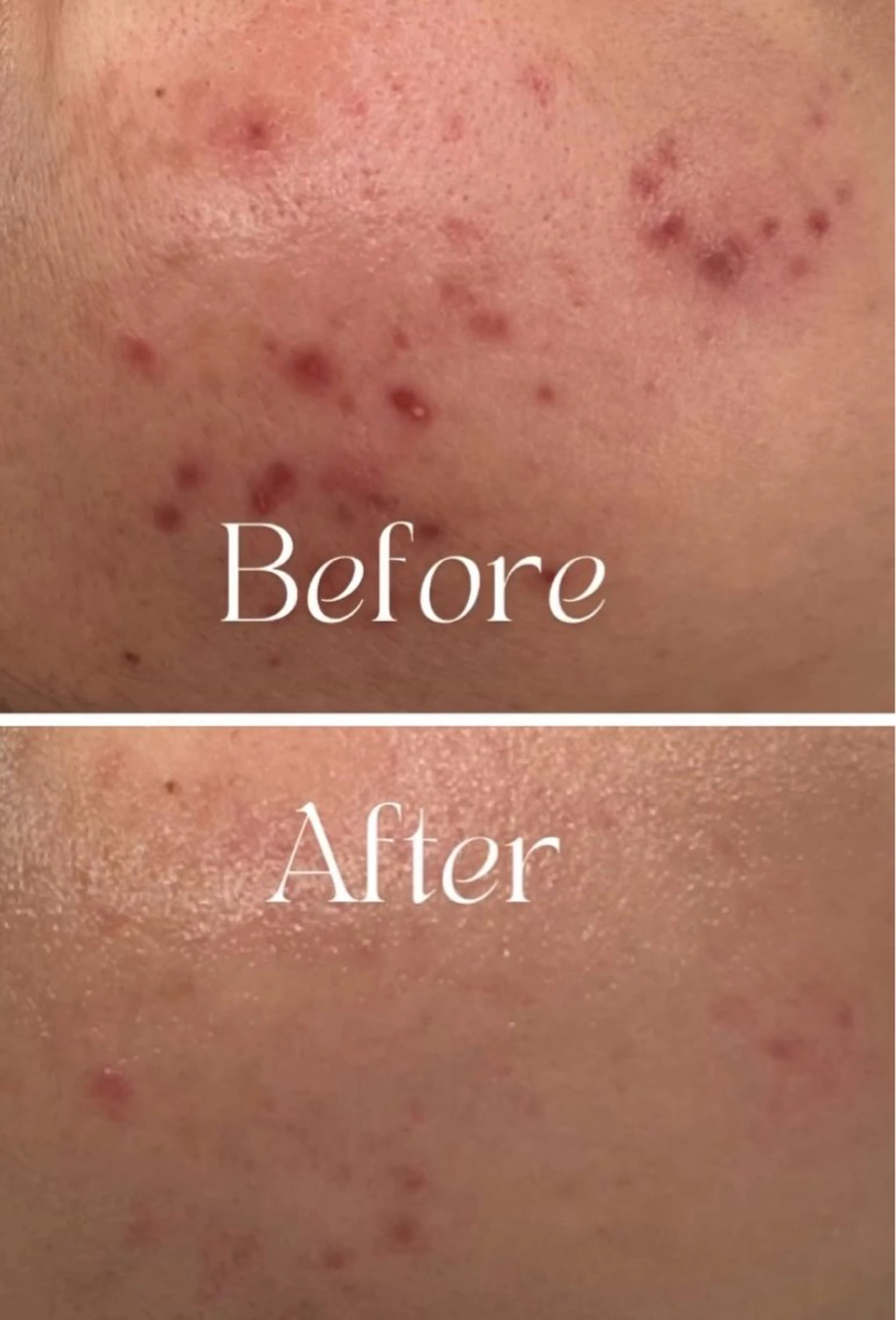 Nature Souce毛穴専門店のその他イメージ