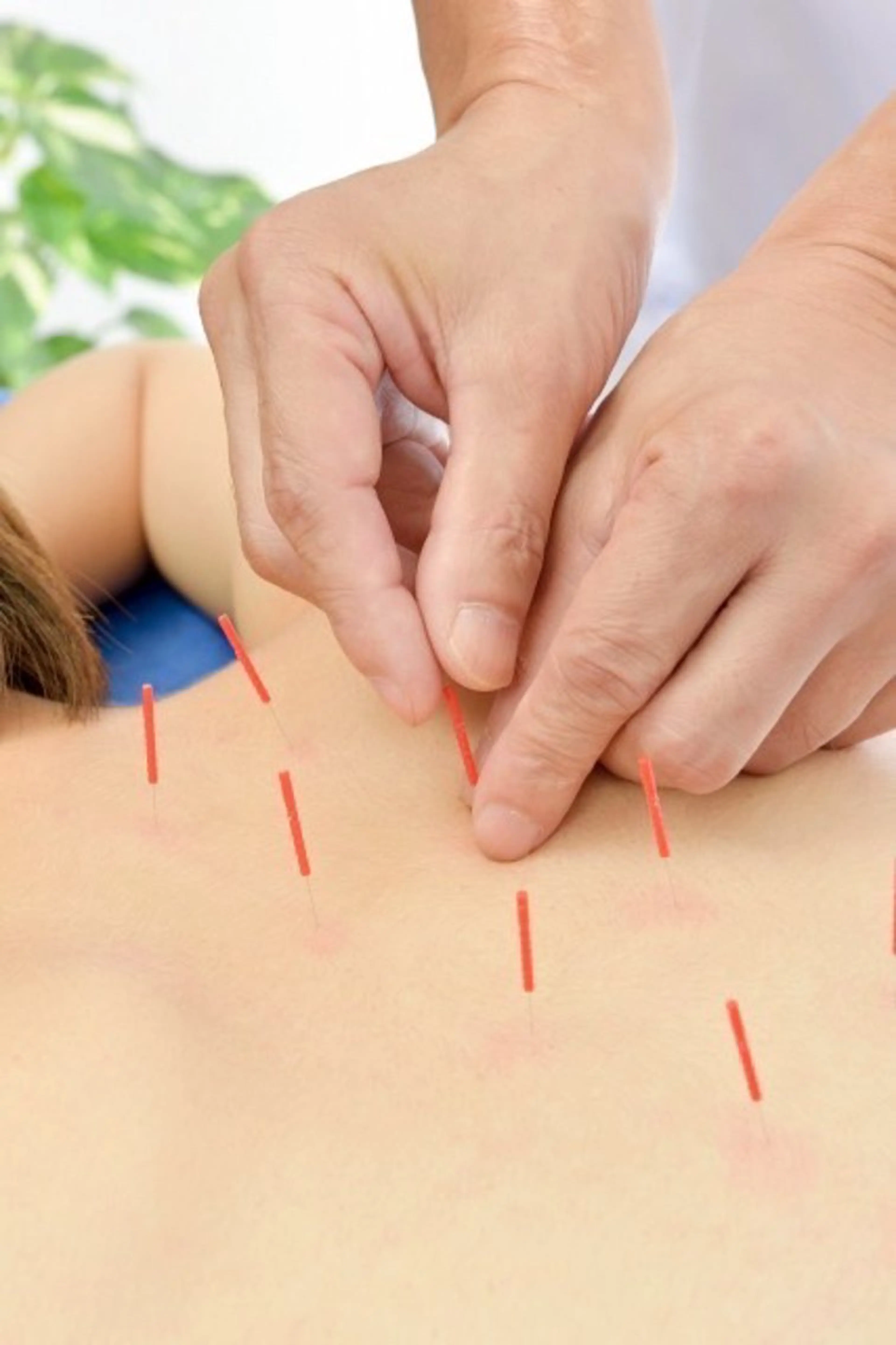 日進町 接骨院のエステ・リラクイメージ