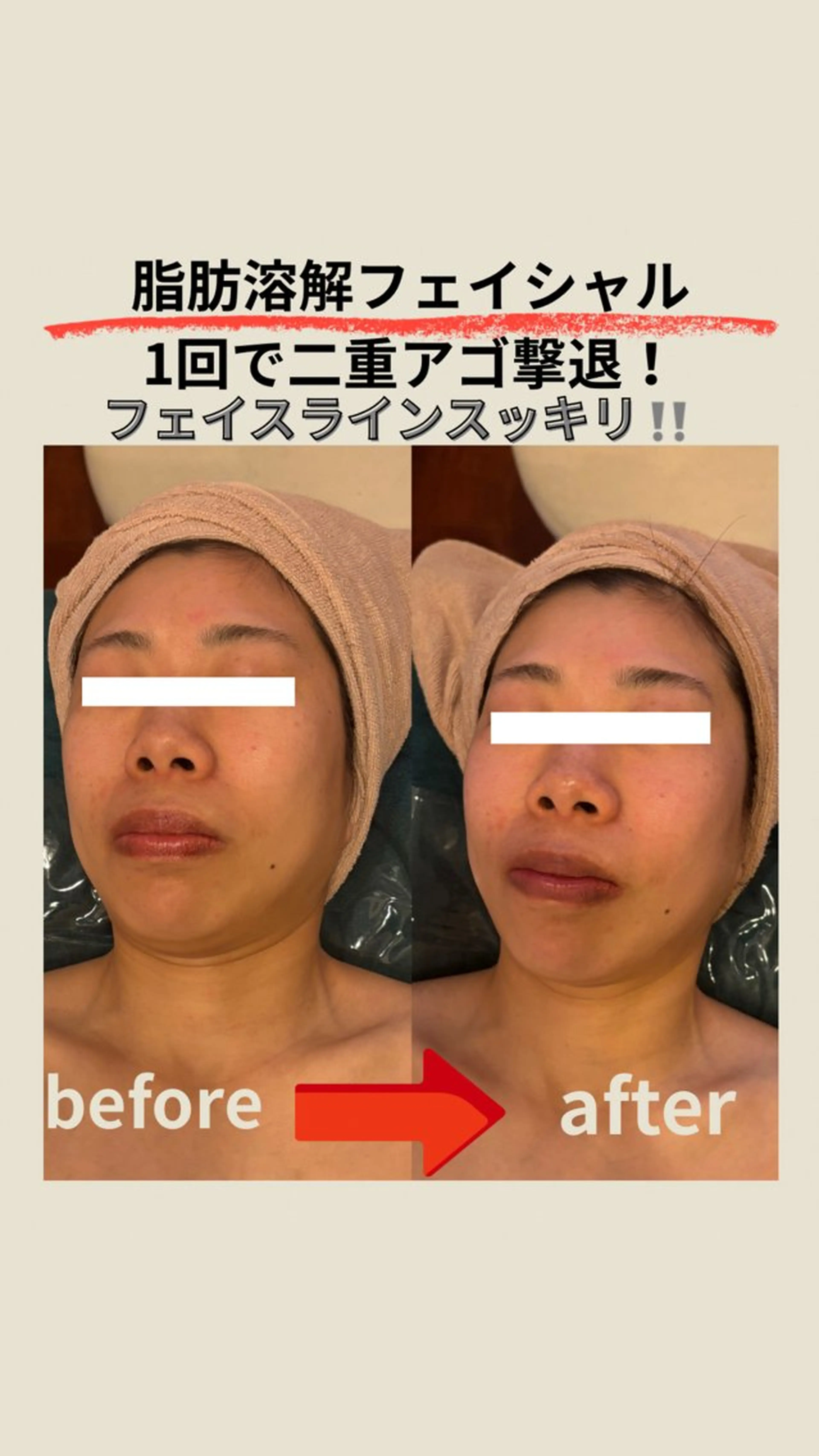 エステ エステサロン グラマラスのエステ・リラクイメージ
