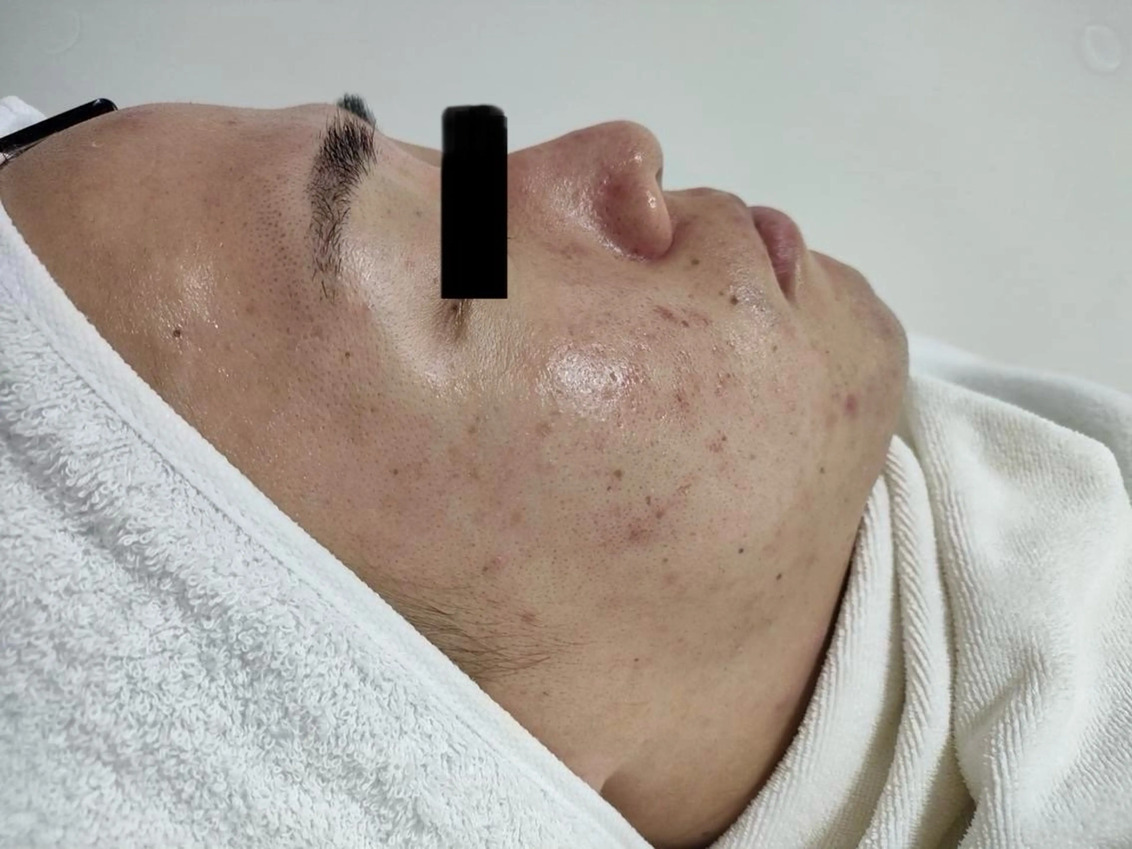 その他 麻布十番エステサロン WhiteAzabuのエステ・リラクイメージ