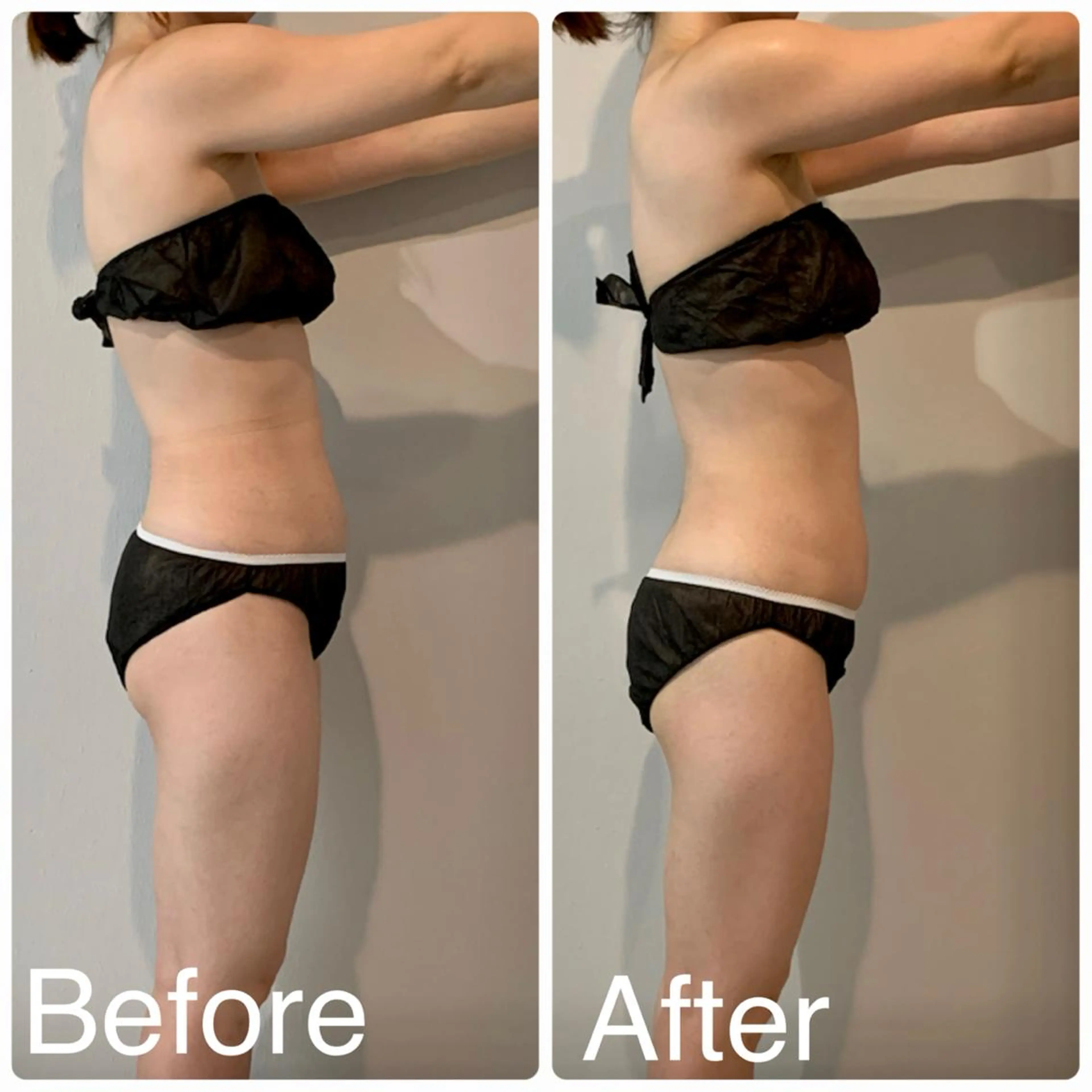 エステ ボディメンテナンス shinomaのエステ・リラクイメージ