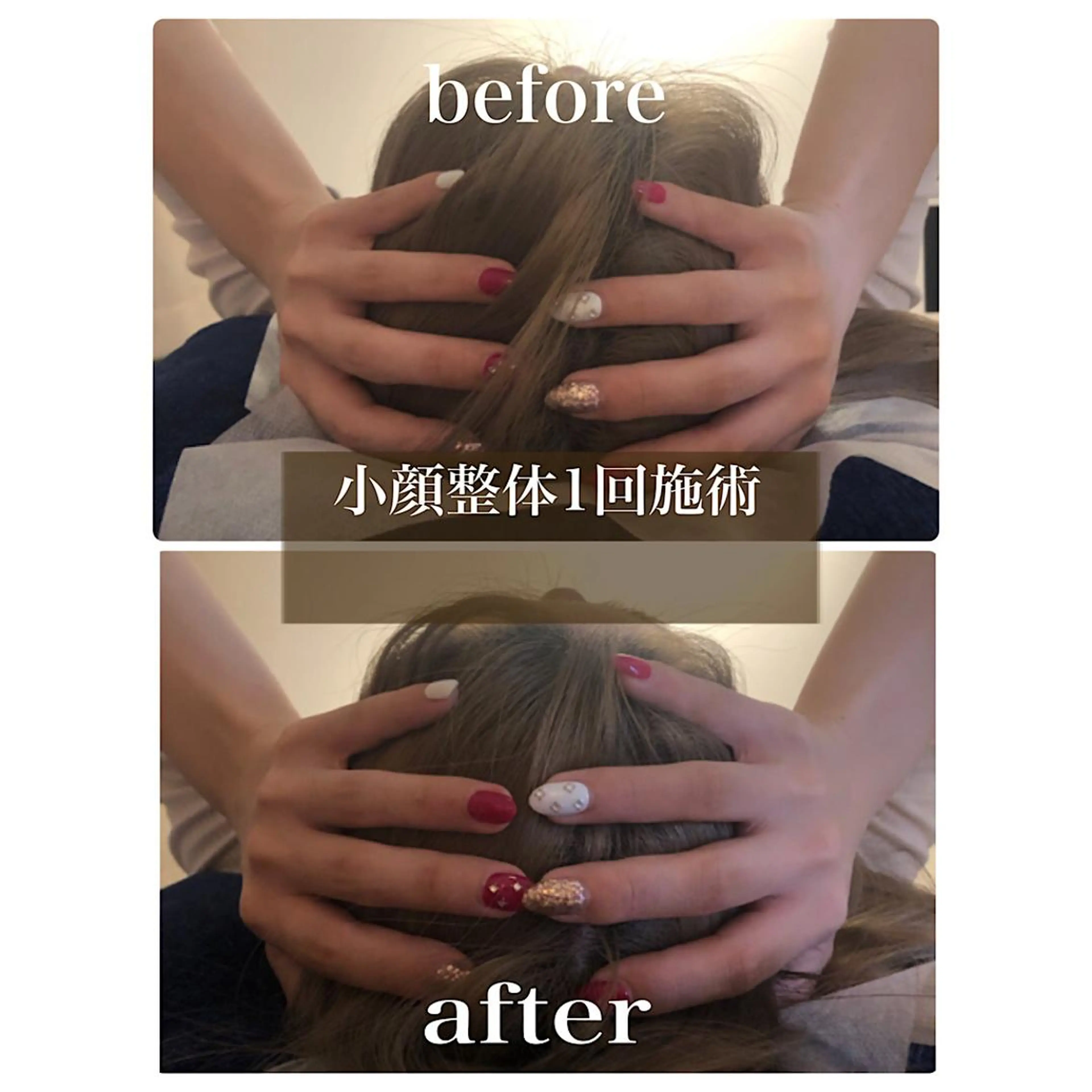 鍼灸整骨院Refine所属・鍼灸 Refineのその他イメージ