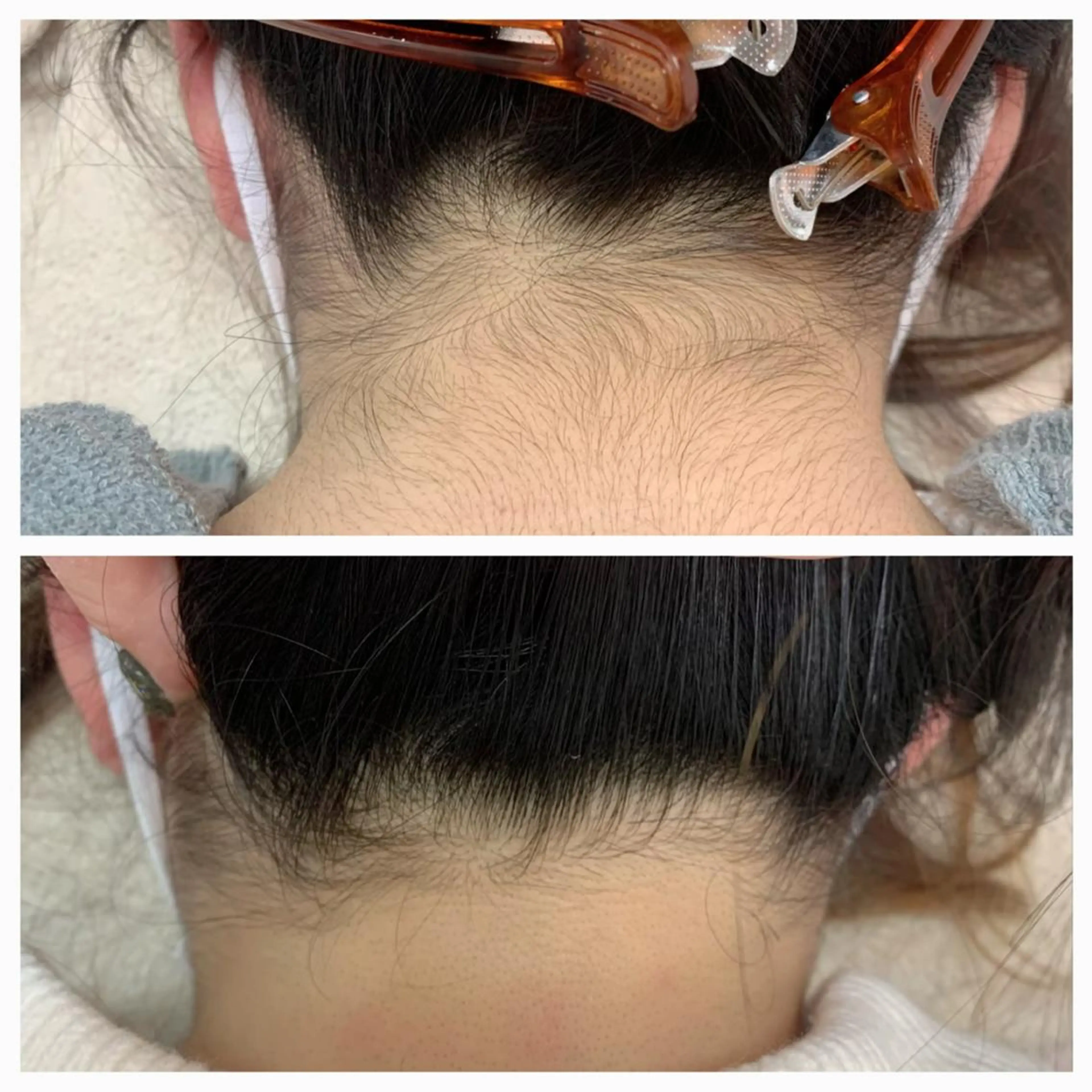 脱毛 MISEREL岡崎店 Ayaのエステ・リラクイメージ