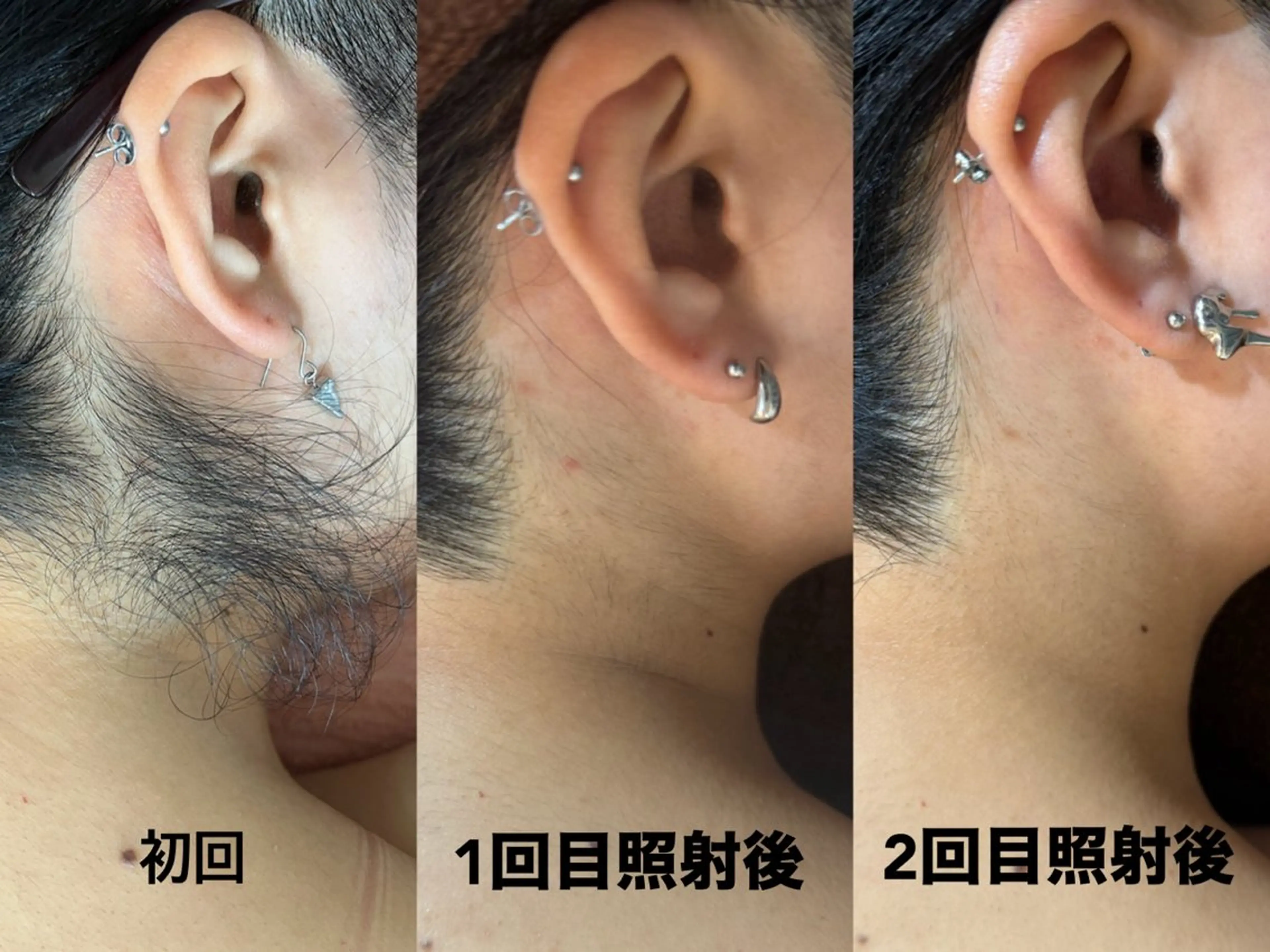 脱毛 AngelWax【エンジェルワックス】新宿店所属・ワックス脱毛/光脱毛 🎀新宿駅徒歩5分のエステ・リラクイメージ