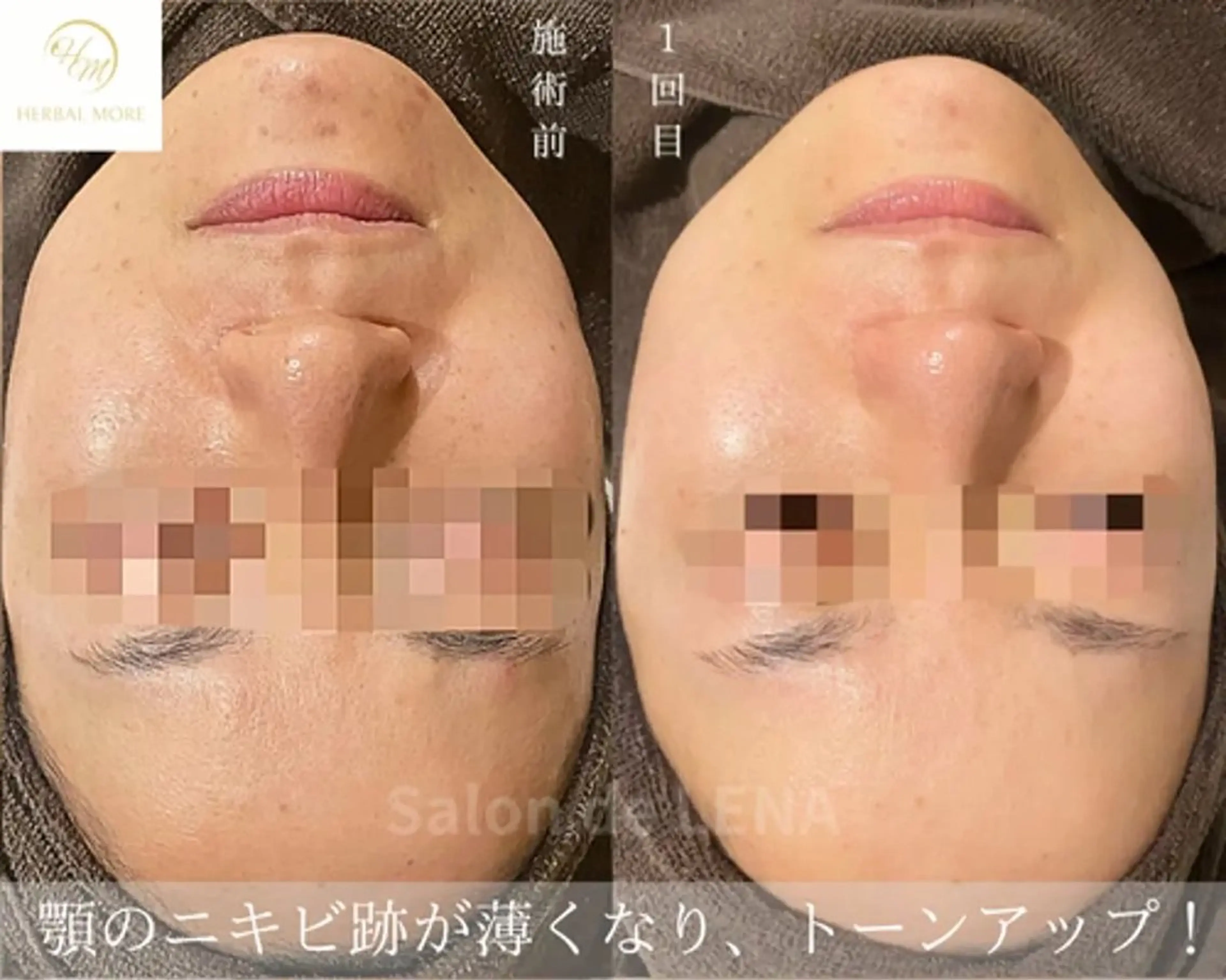 ハーブピーリング専門 グランディール　武内のエステ・リラクイメージ