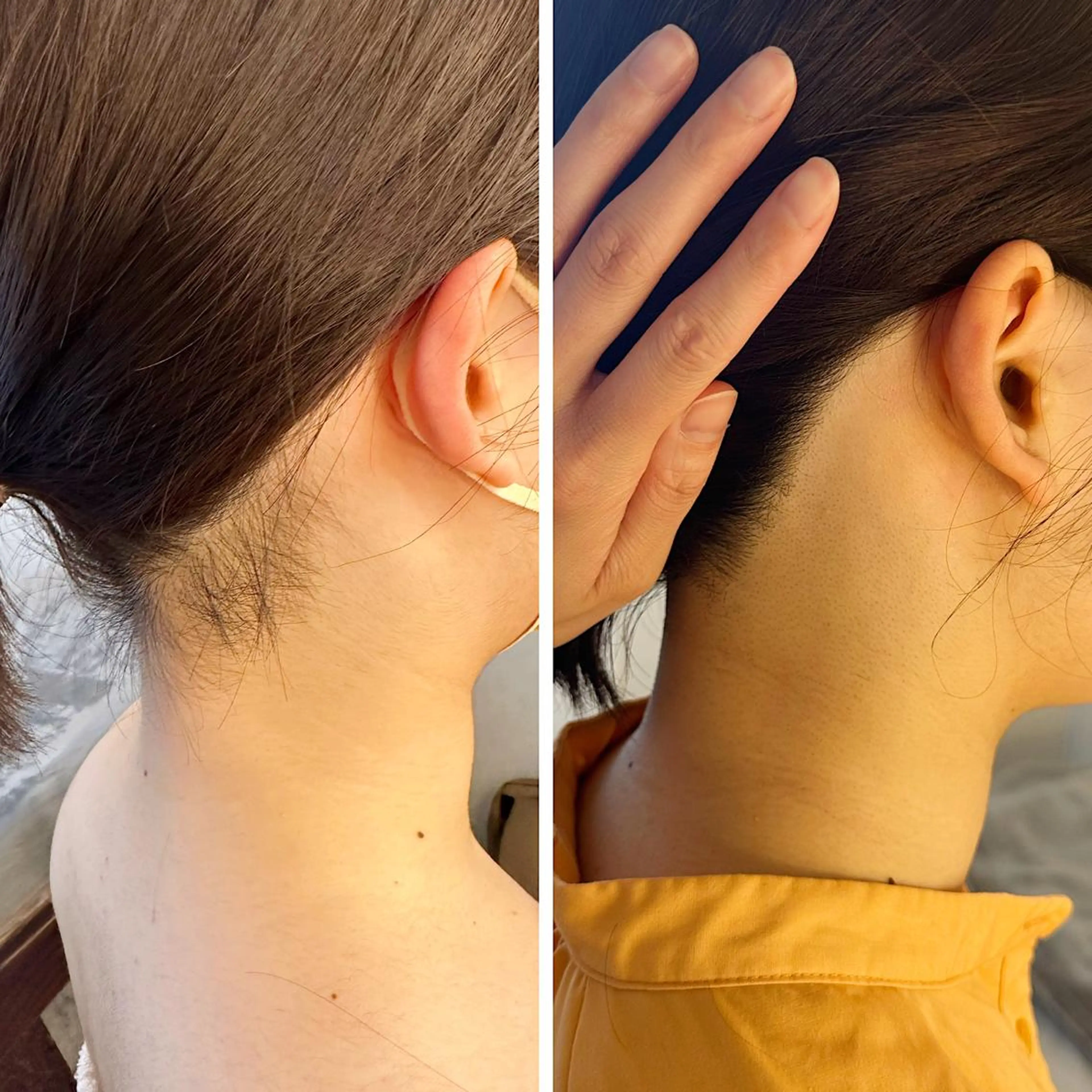 脱毛 うなじ脱毛/美肌脱毛 LABELのエステ・リラクイメージ