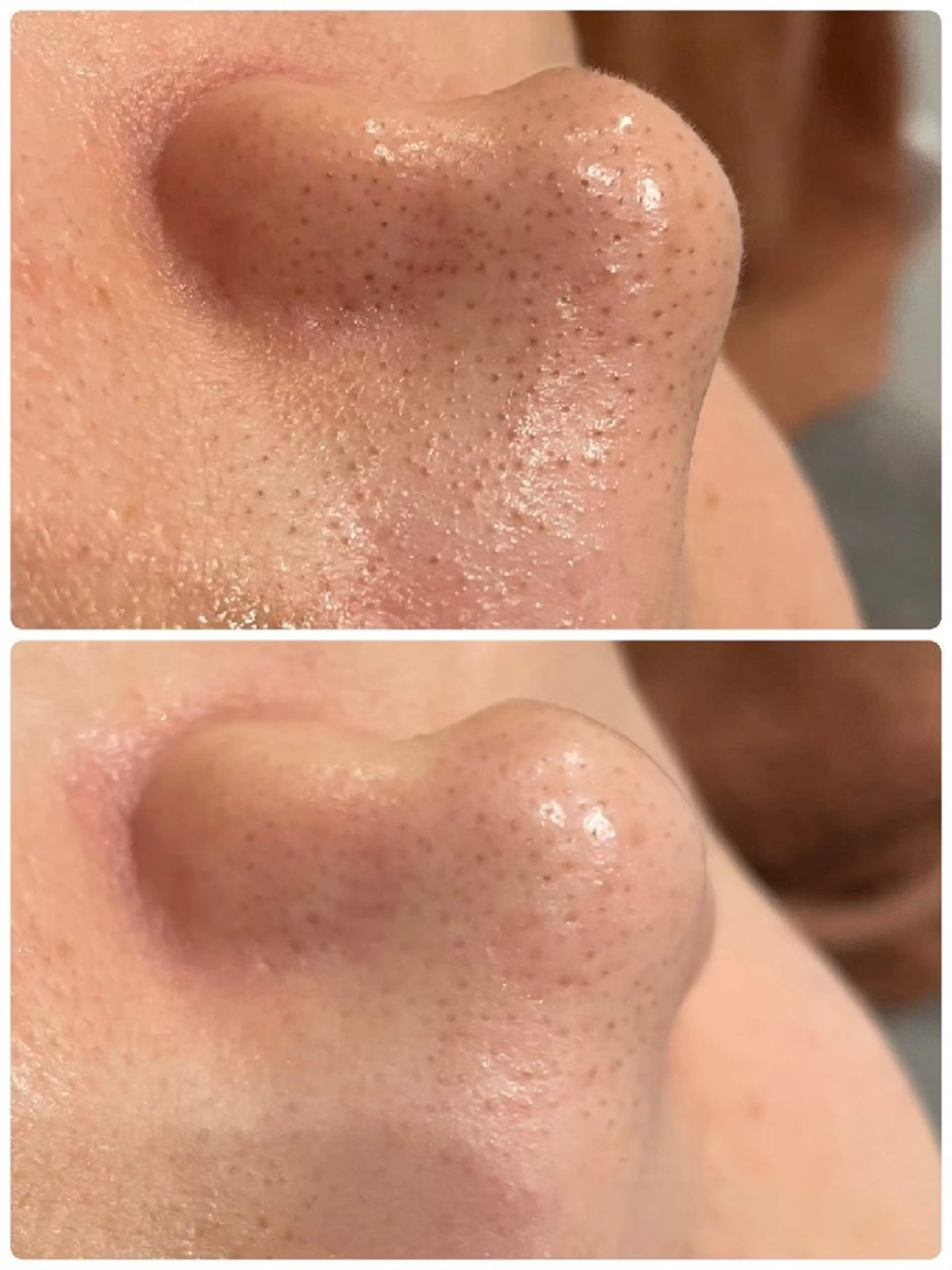 エステ pono_salon所属・pono_ salon のエステ・リラクイメージ