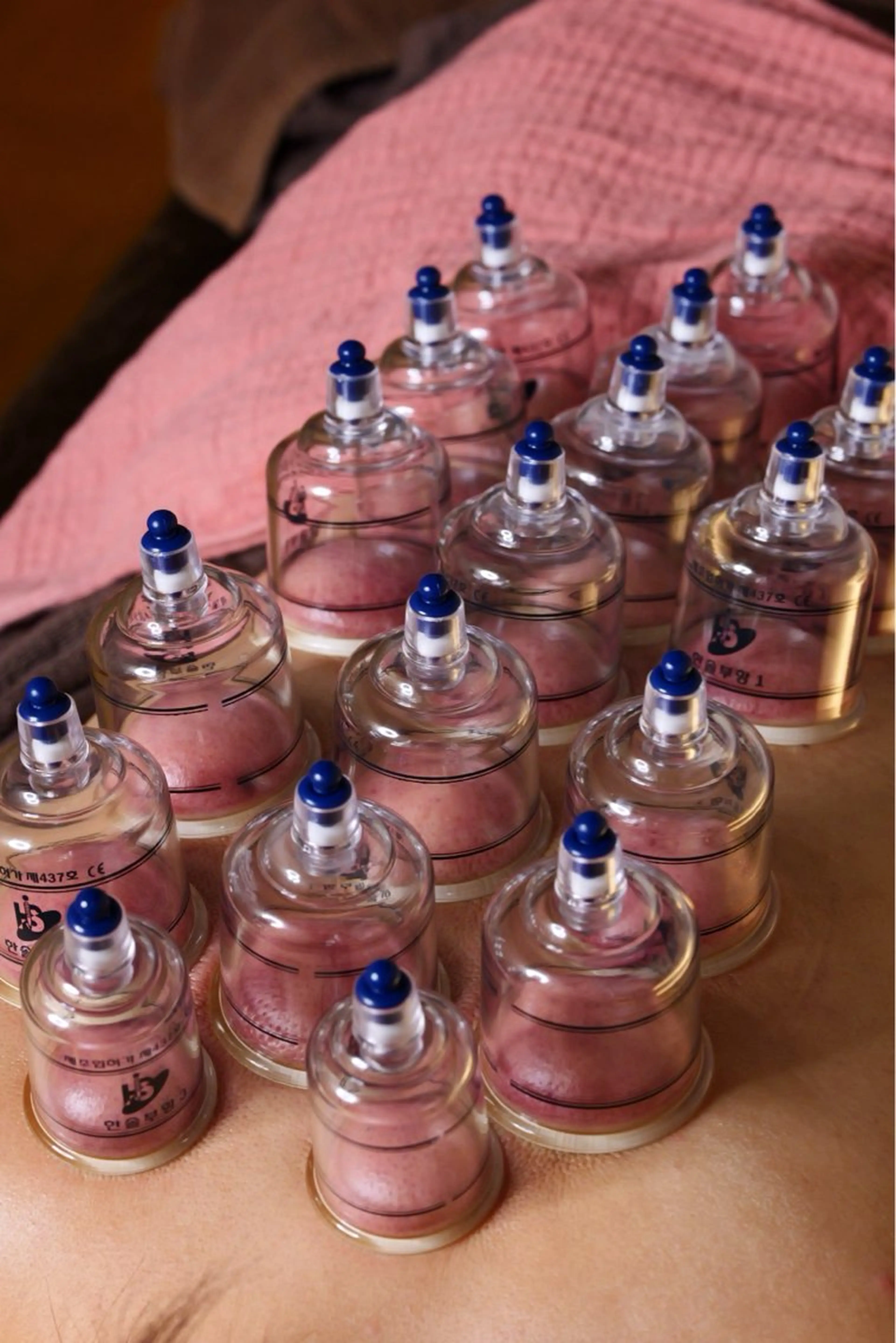 【巡りを整えて、頭と体の重さを流す】カッピング×脳休ヘッドマッサージ 60分の写真