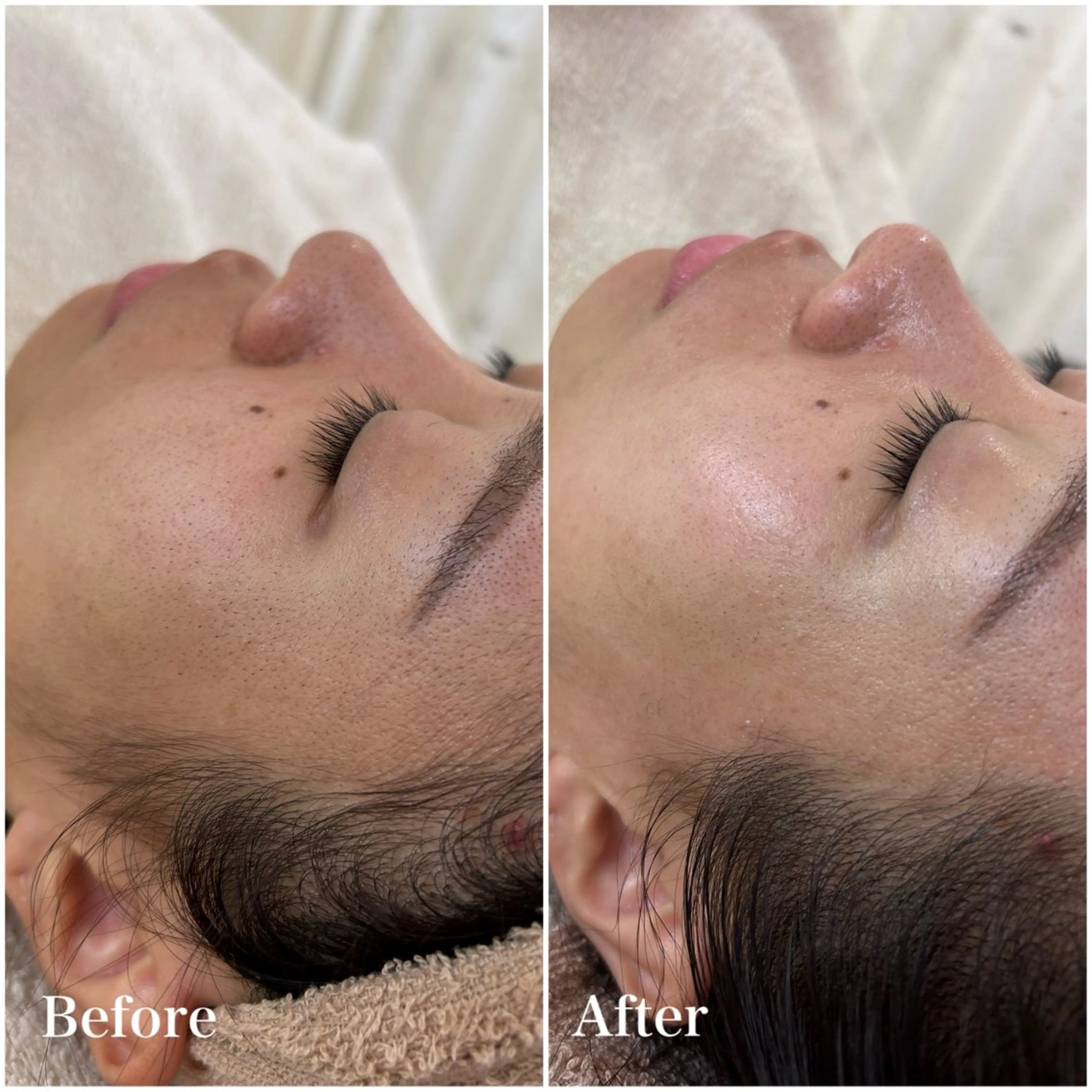 美肌育成専門サロンラクシュミー所属・毛穴肌管理サロン ラクシュミーのエステ・リラクイメージ