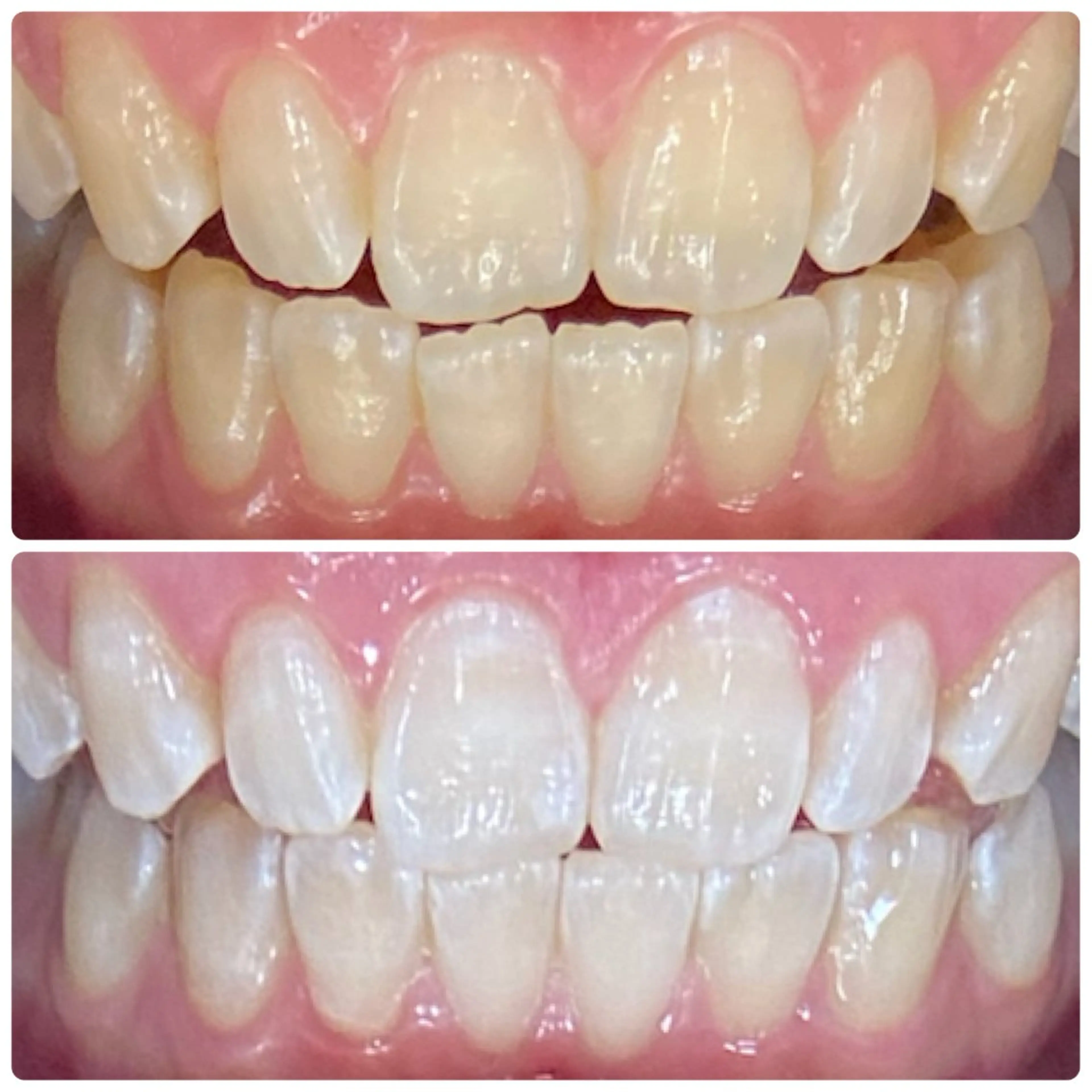 ホワイトニングルーム 横浜店のその他イメージ