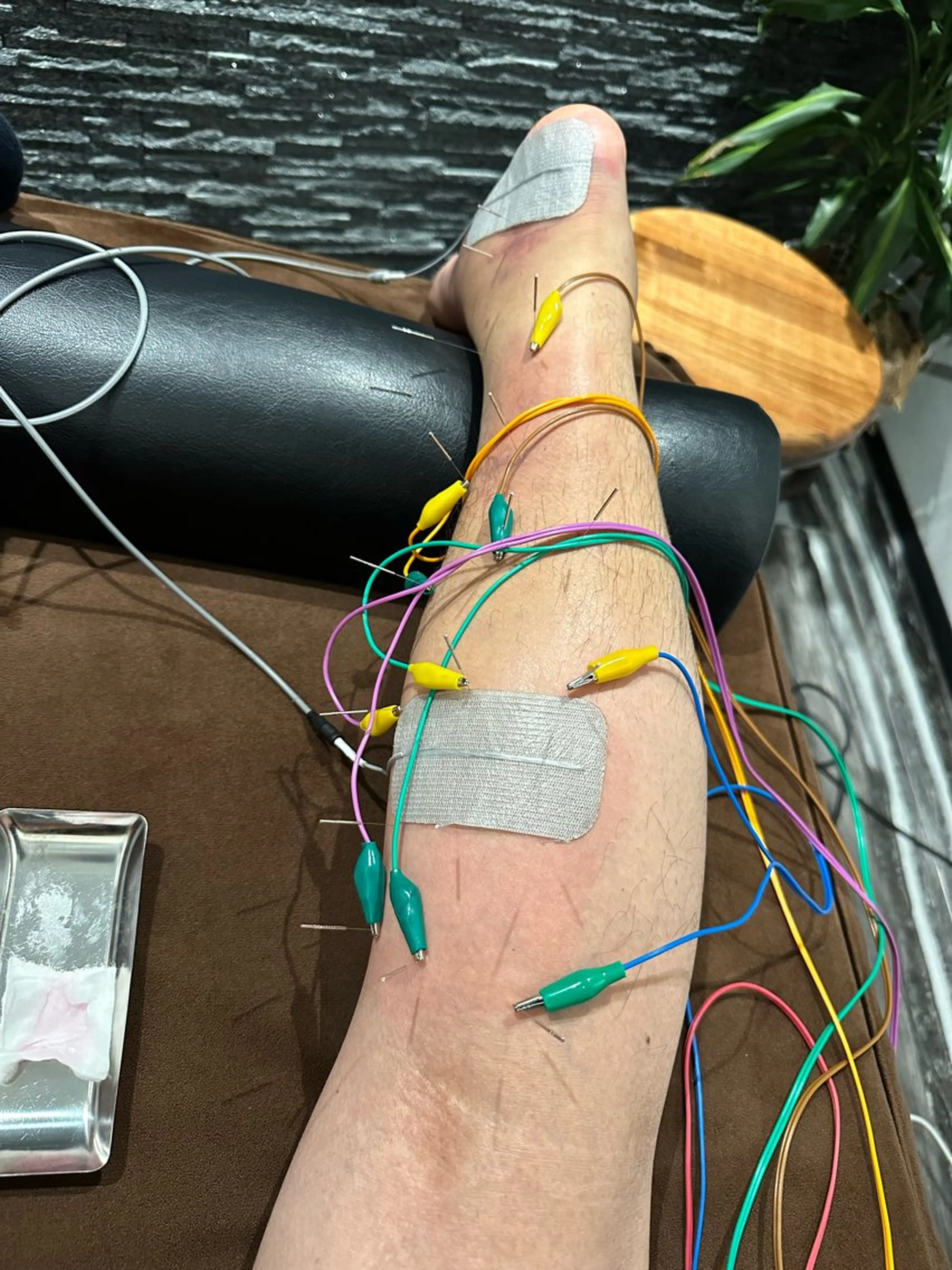 その他 美容鍼灸整体サロンBeauJu所属・小顔矯/美容鍼/鍼灸 BeauJuのその他イメージ