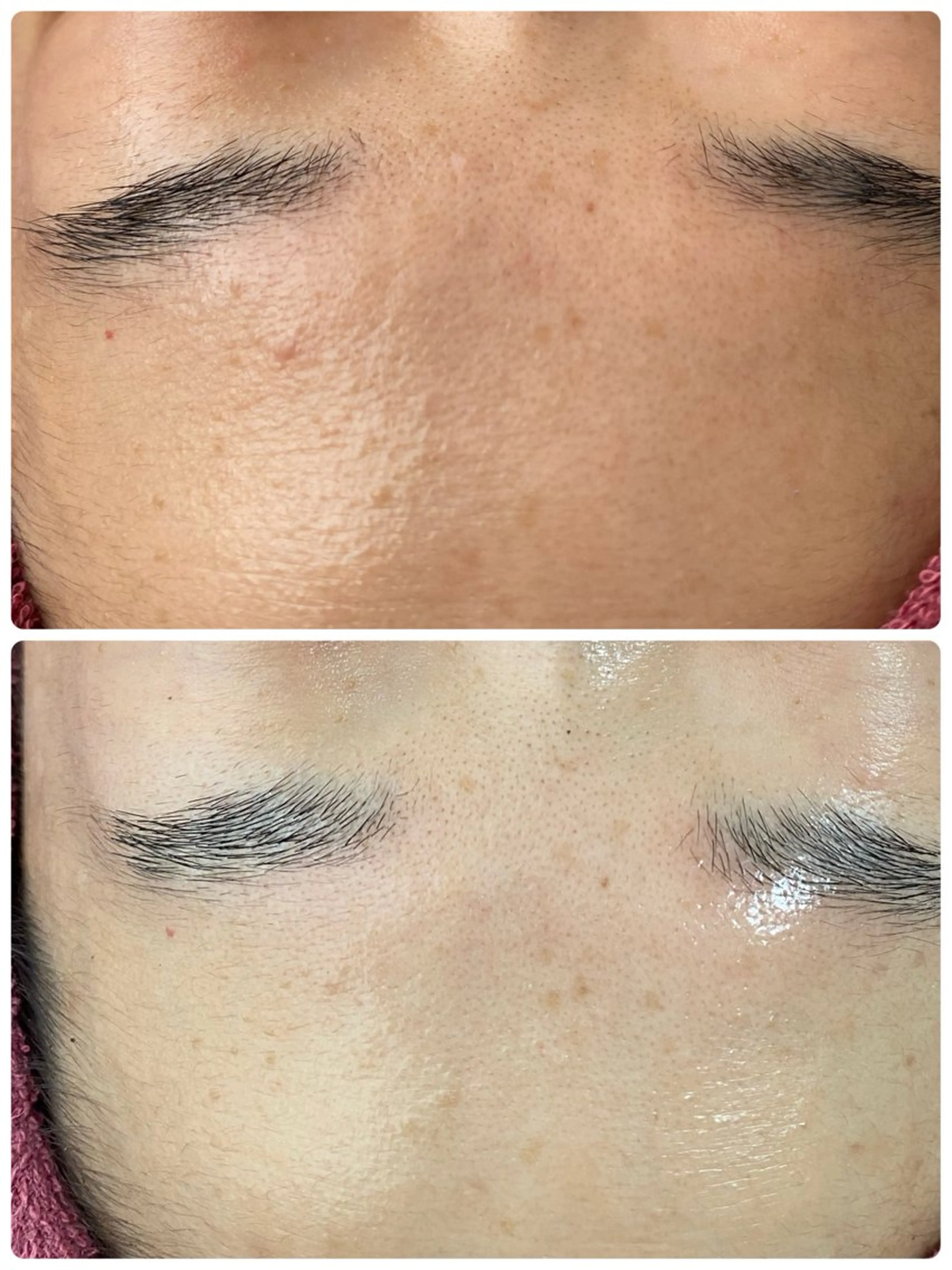 エステ REVI取扱・肌悩み 毛穴Chalonのエステ・リラクイメージ