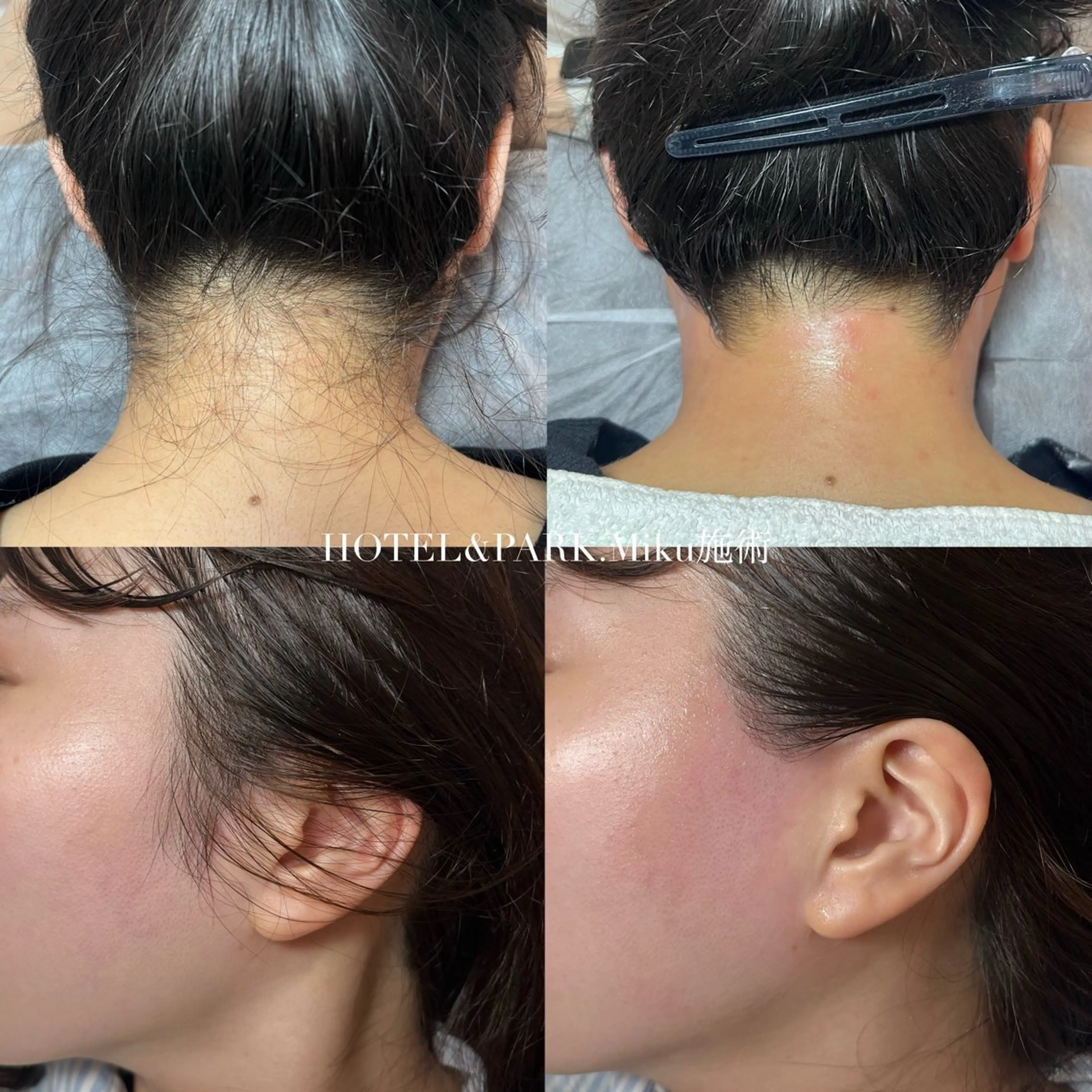 HOTEL&PARK Mikuワックス脱毛のエステ・リラクイメージ