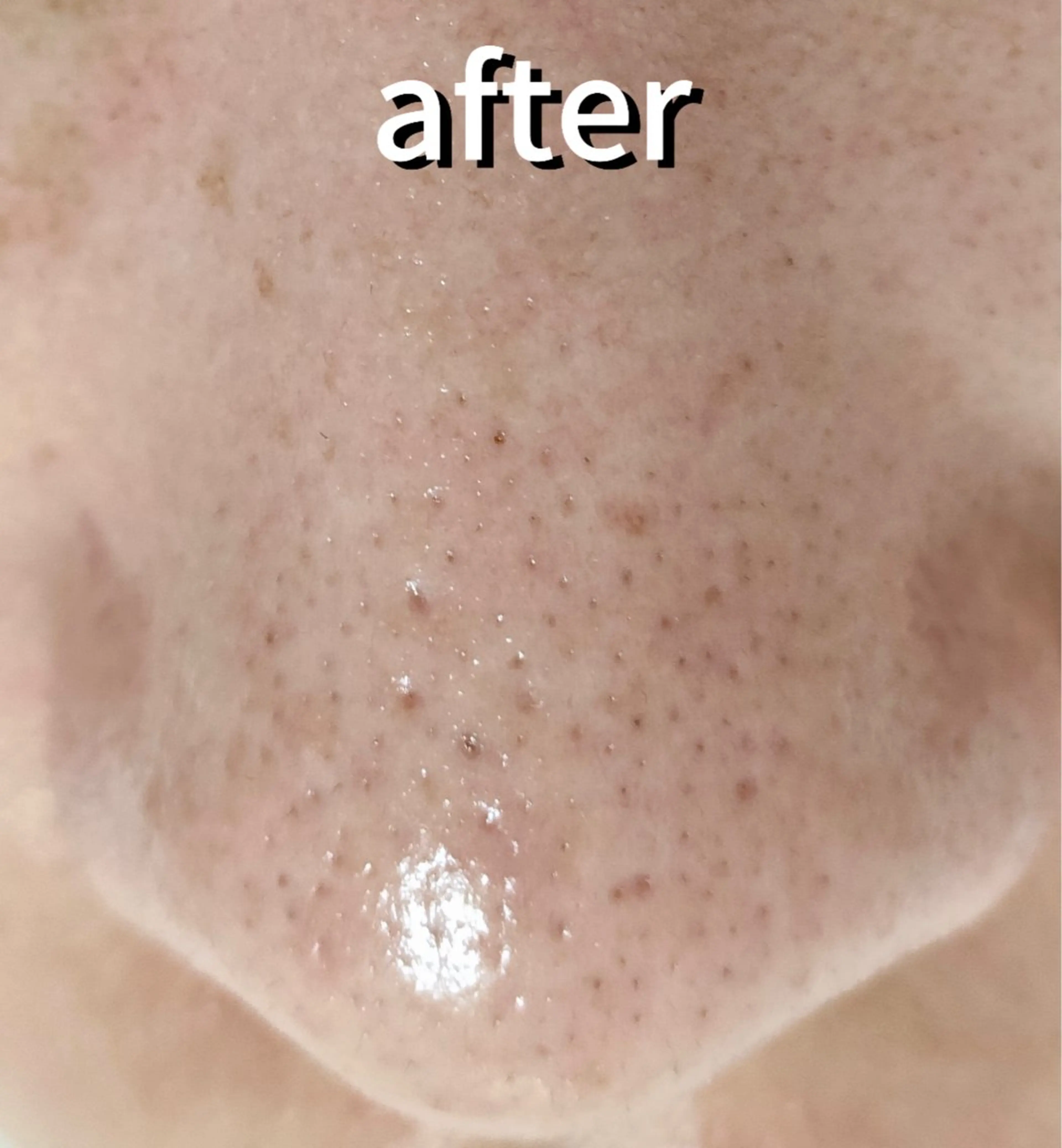 その他 麻布十番エステサロン WhiteAzabuのエステ・リラクイメージ