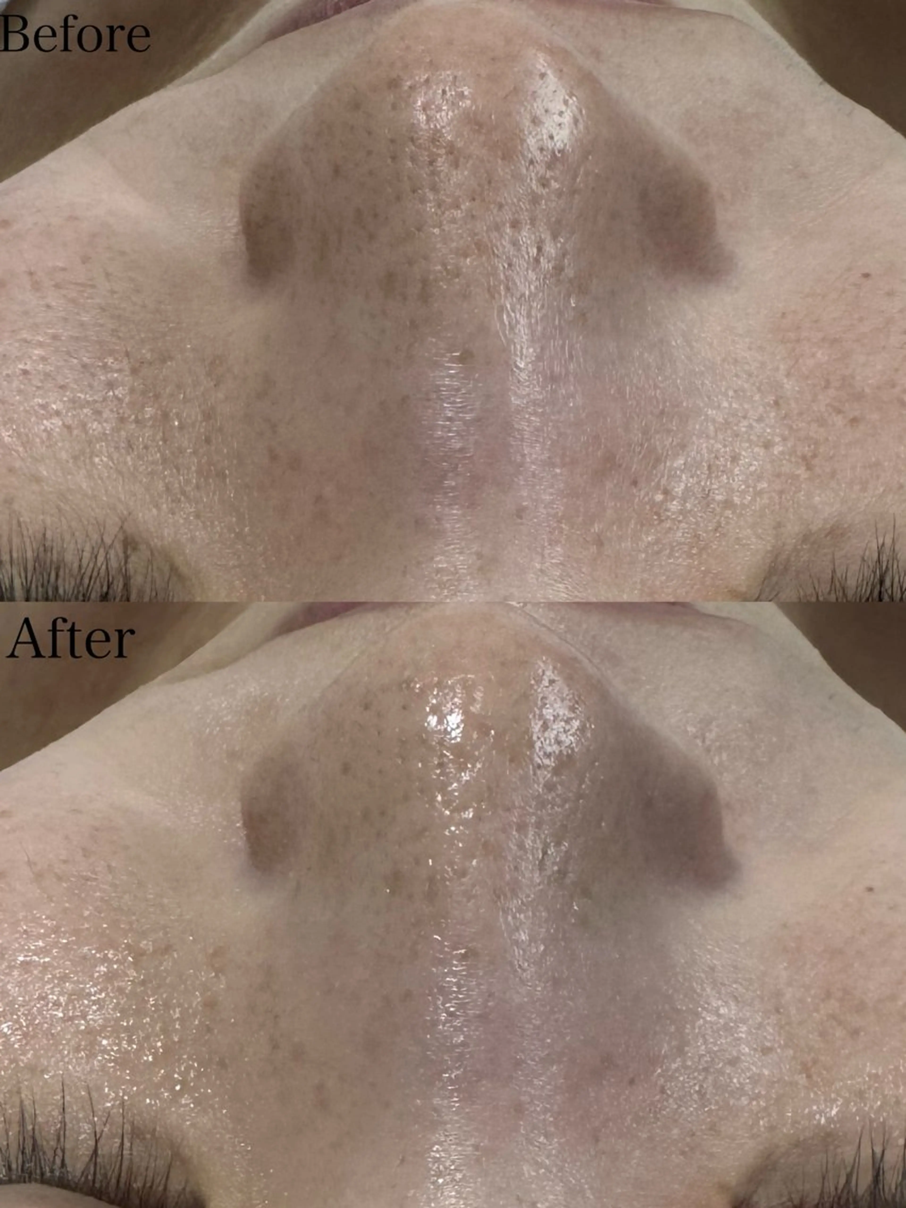 エステ beautysalon LIMOA所属・松本 愛絵理のエステ・リラクイメージ