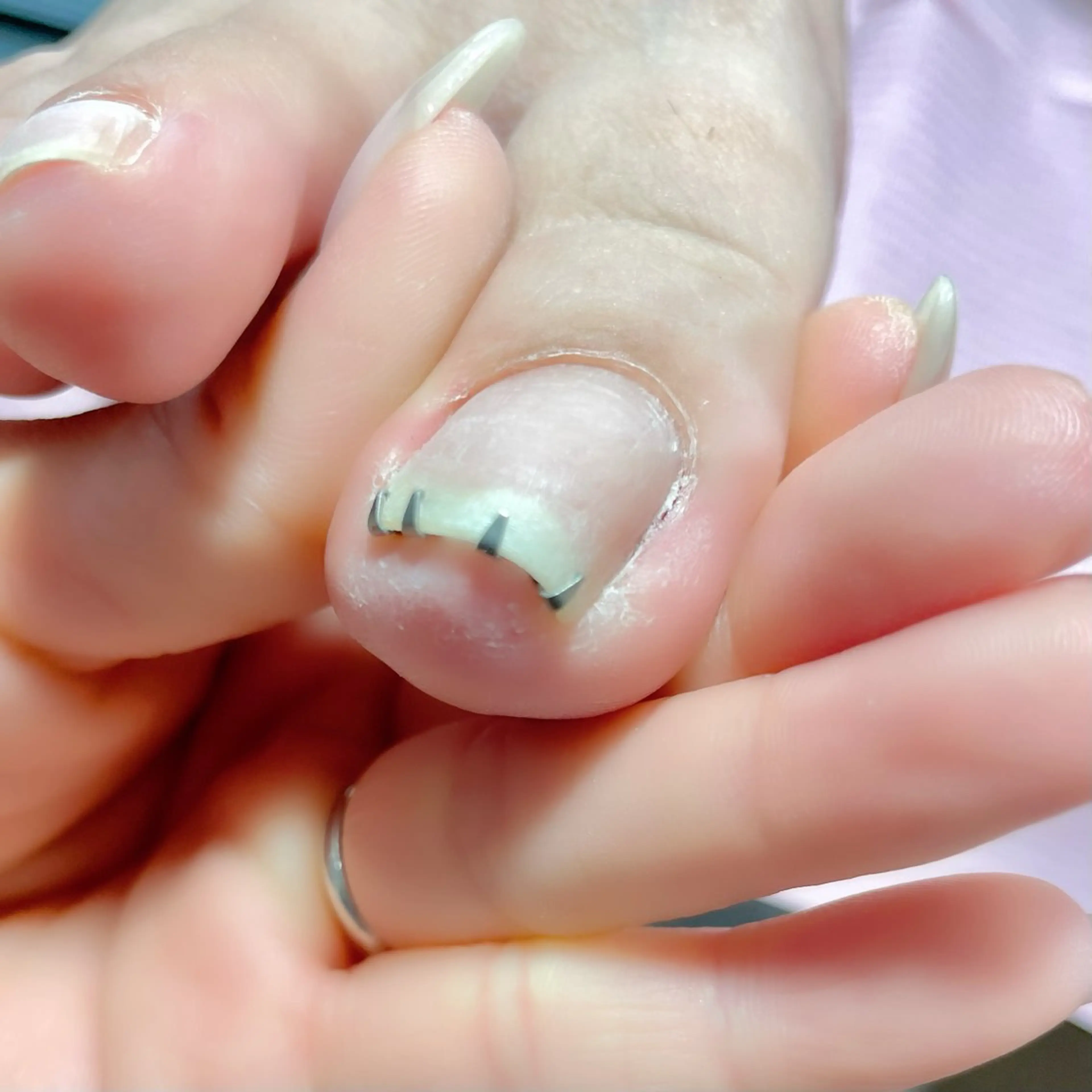 ネイル nail salon ワンミリオンのネイルデザイン