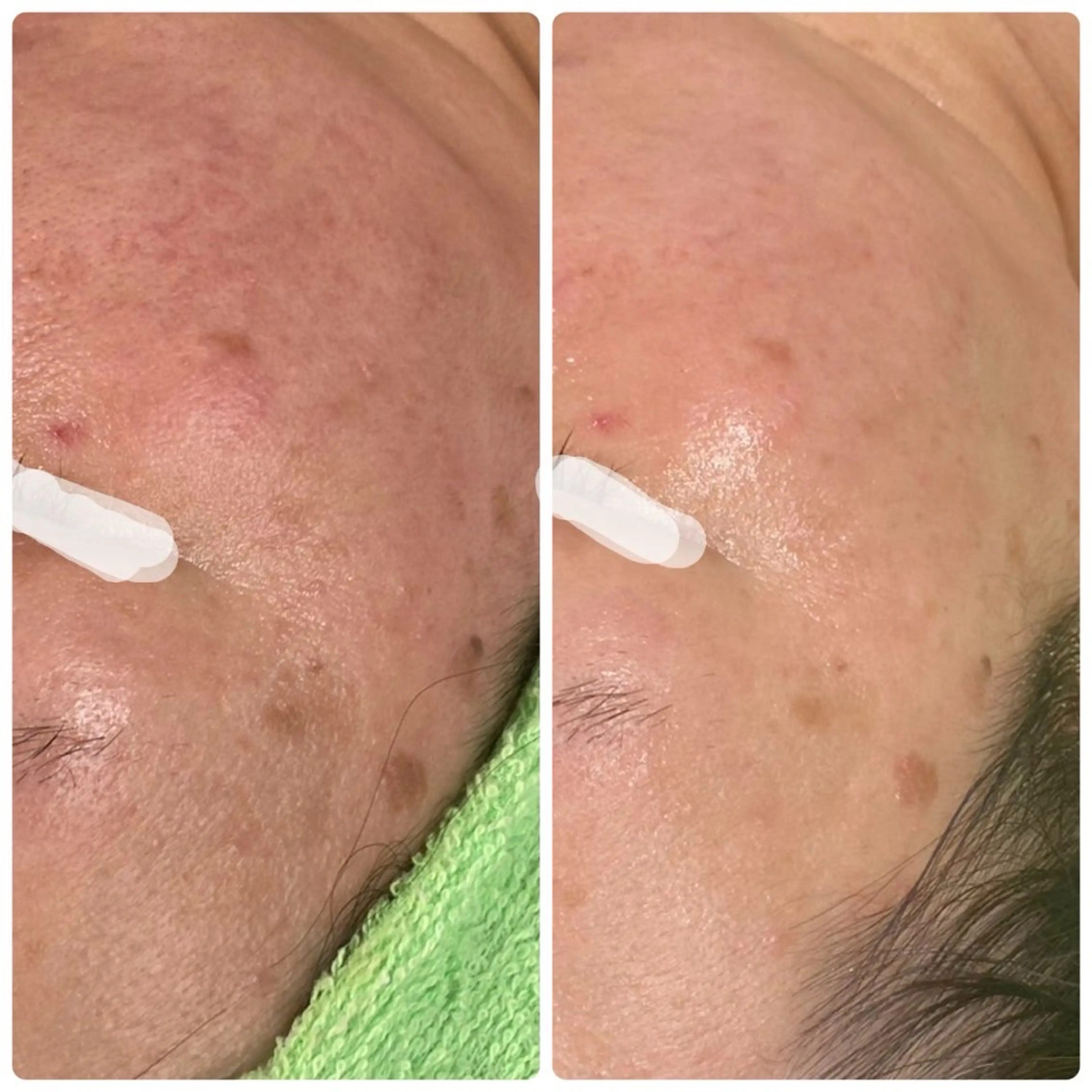 その他 プライベート美容脱毛 JR久宝寺徒歩1分のエステ・リラクイメージ