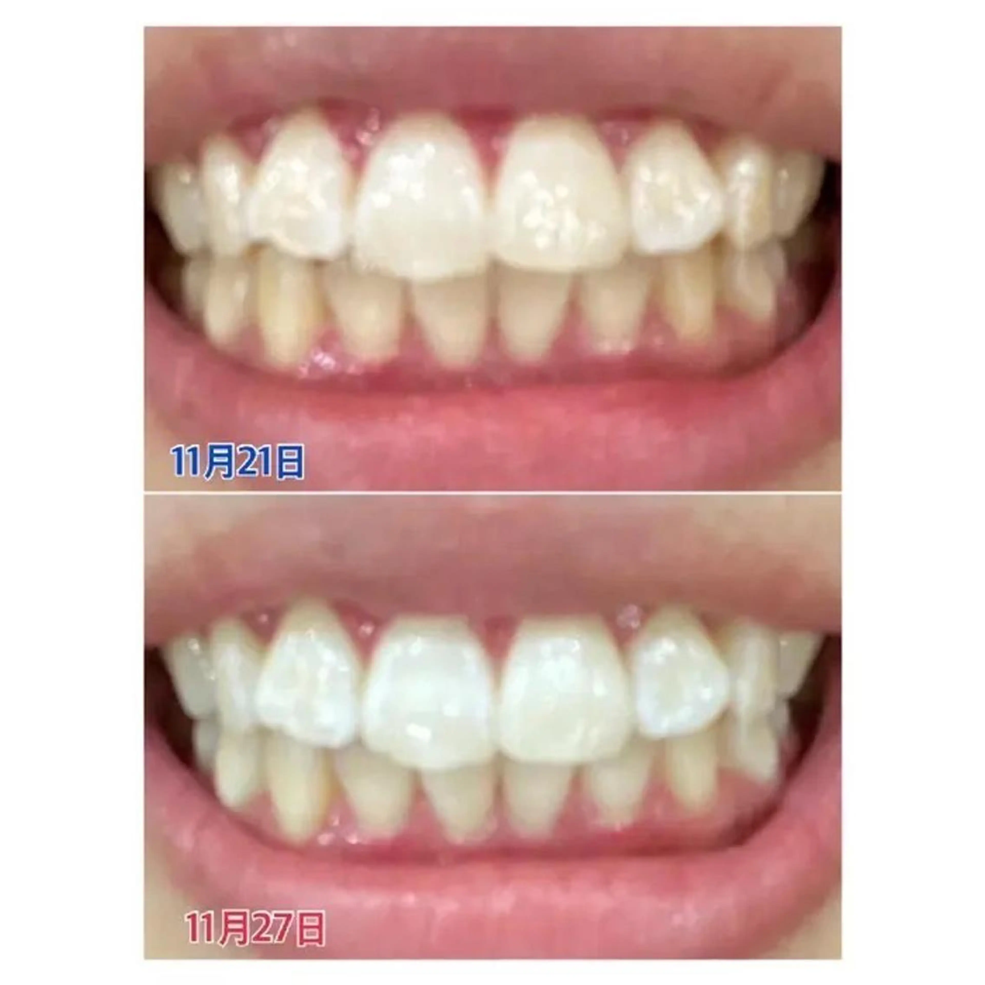 M渋谷 ホワイトニングのその他イメージ