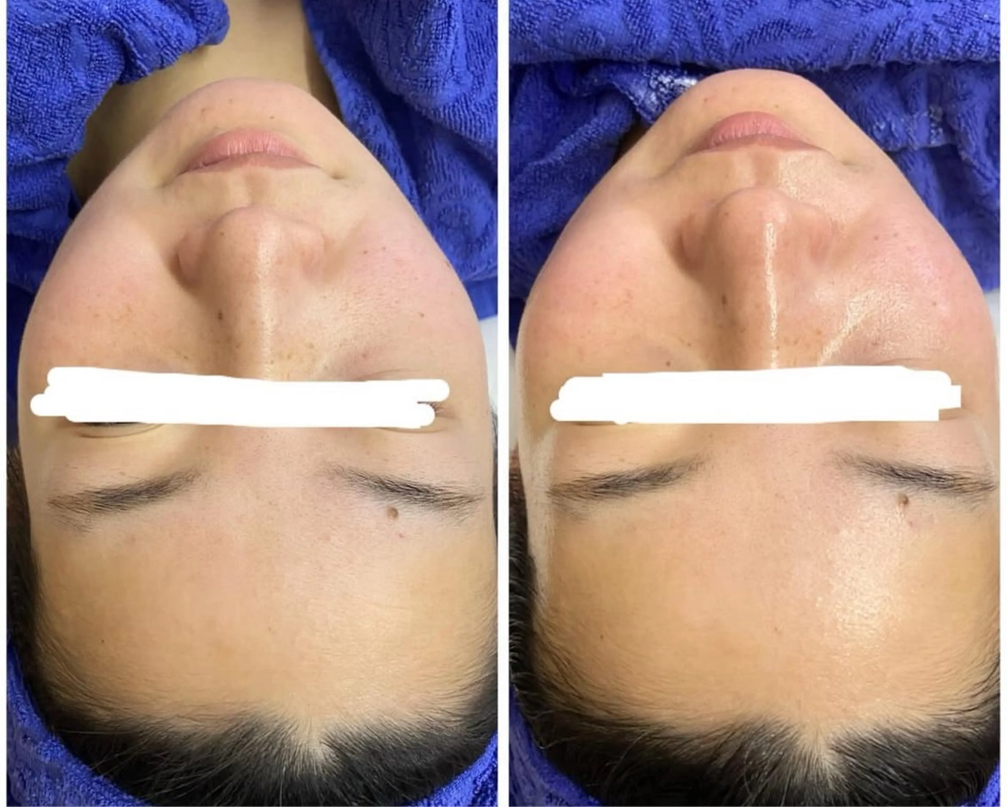 エステ ビューティーサロン　プリズム所属・久留本 茜のエステ・リラクイメージ