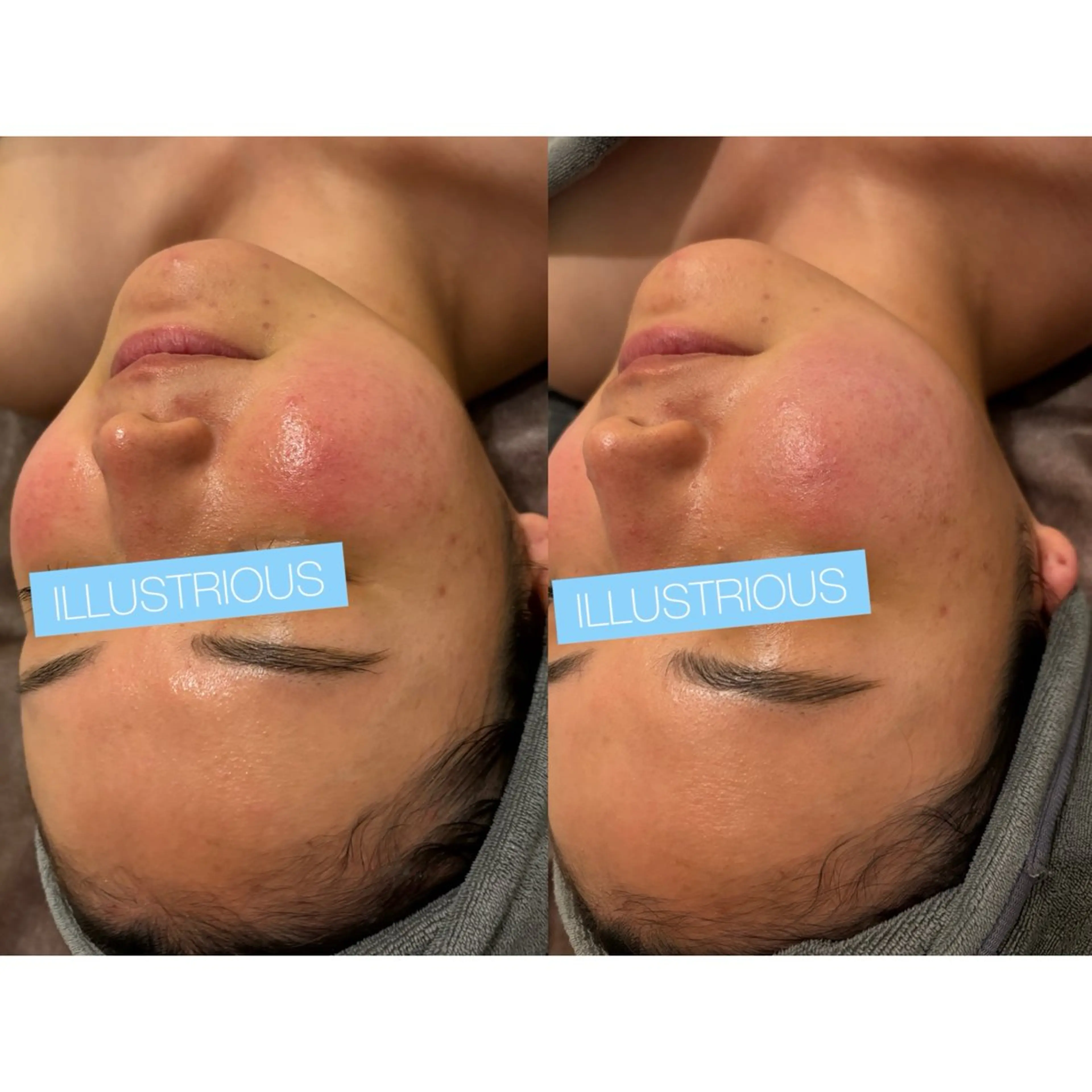 小顔コルギ ☆表参道/外苑前のエステ・リラクイメージ