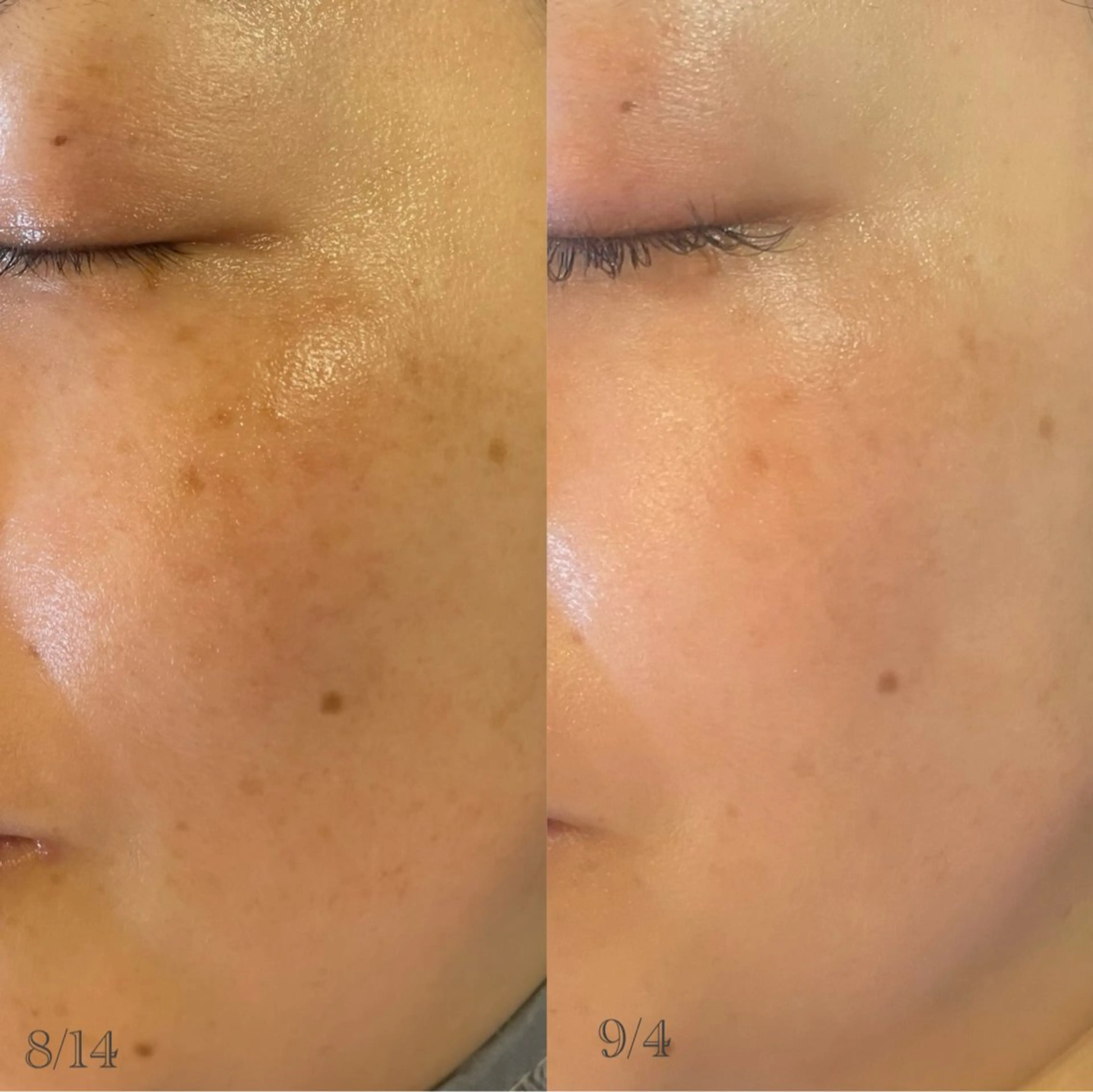 〚博多〛フィユ 水江のマツエク・マツパデザイン