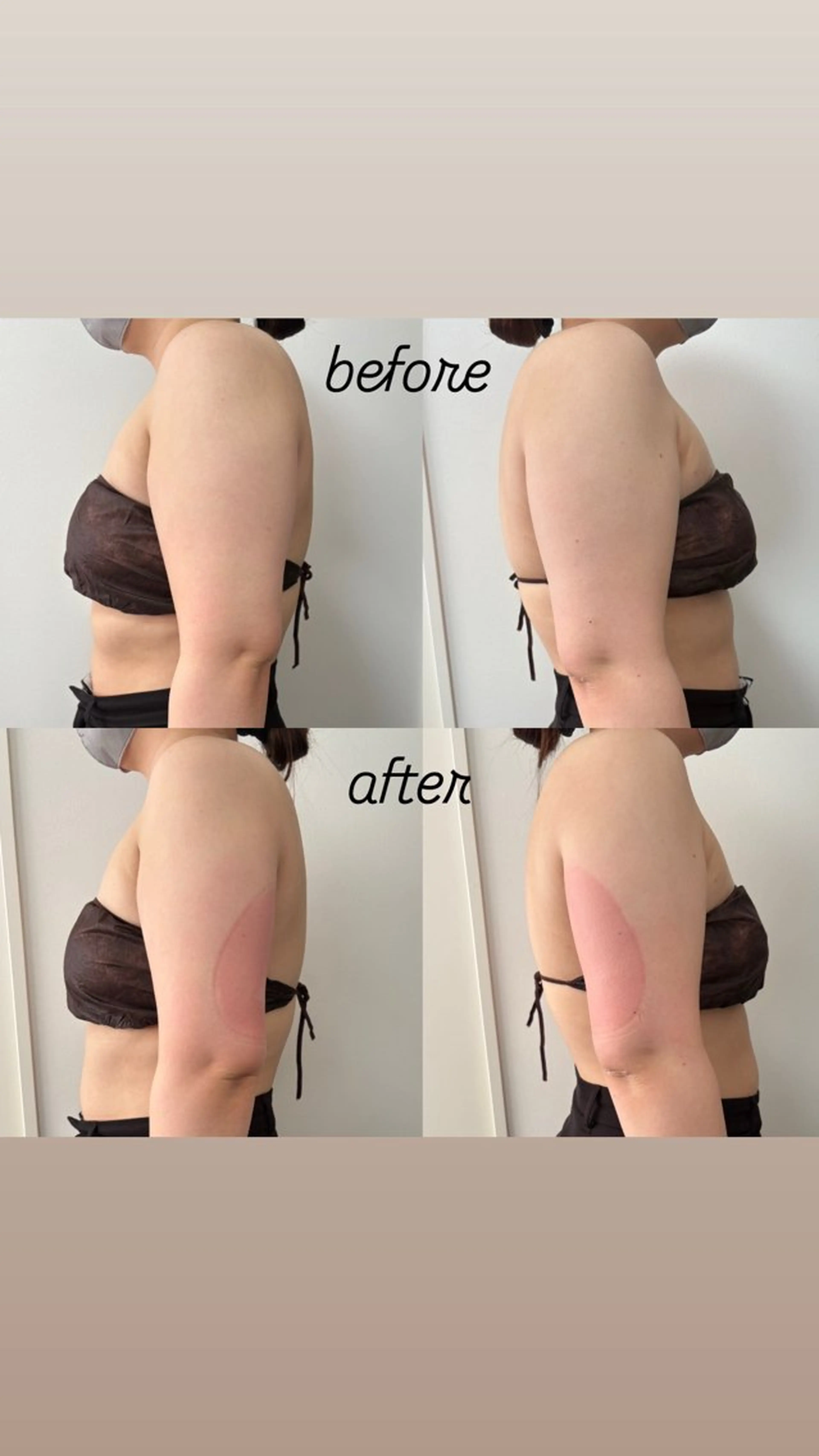 石巻 冷却痩身 Miiju. 鈴木のエステ・リラクイメージ