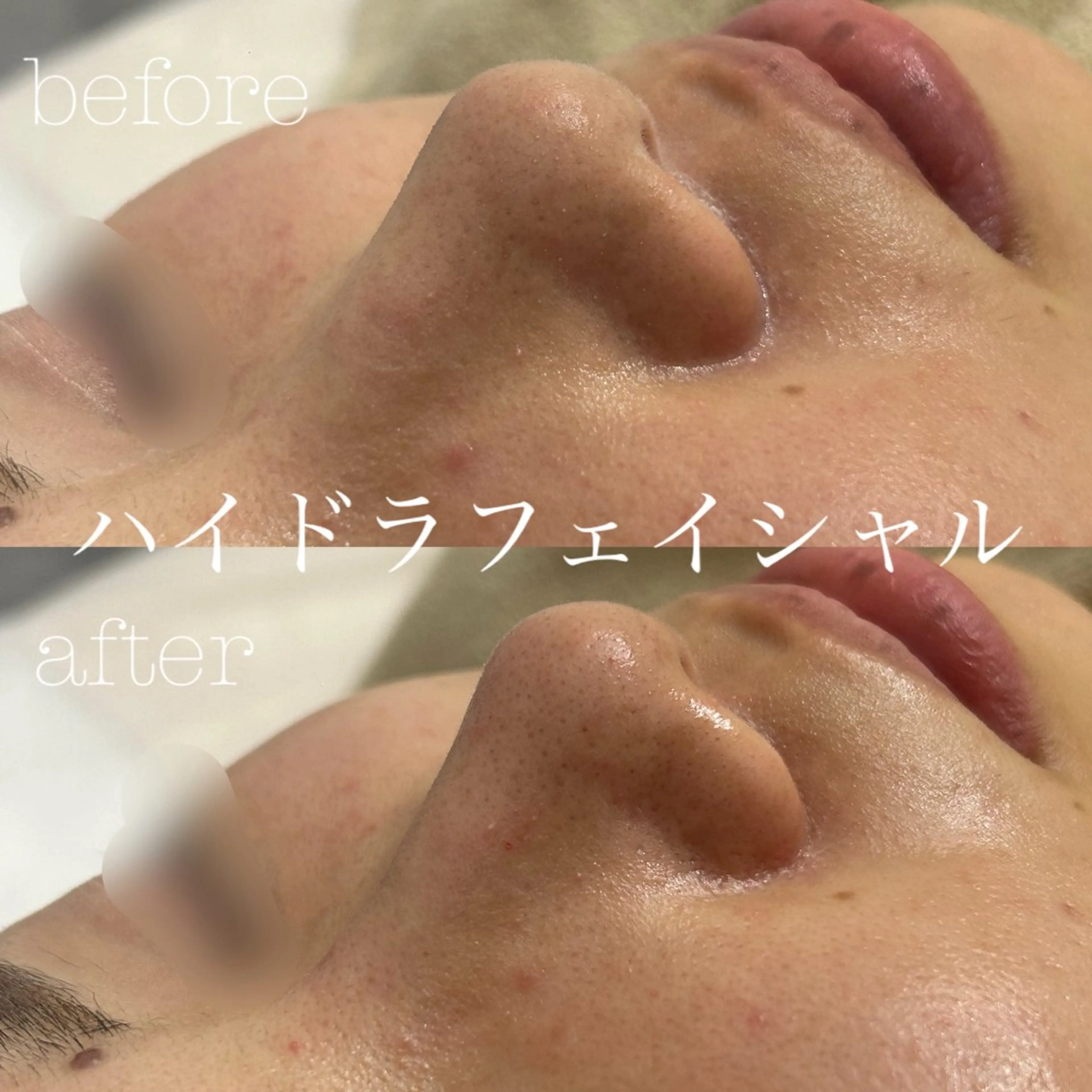 エステ フェイシャルサロン CHIARA 荒田のエステ・リラクイメージ