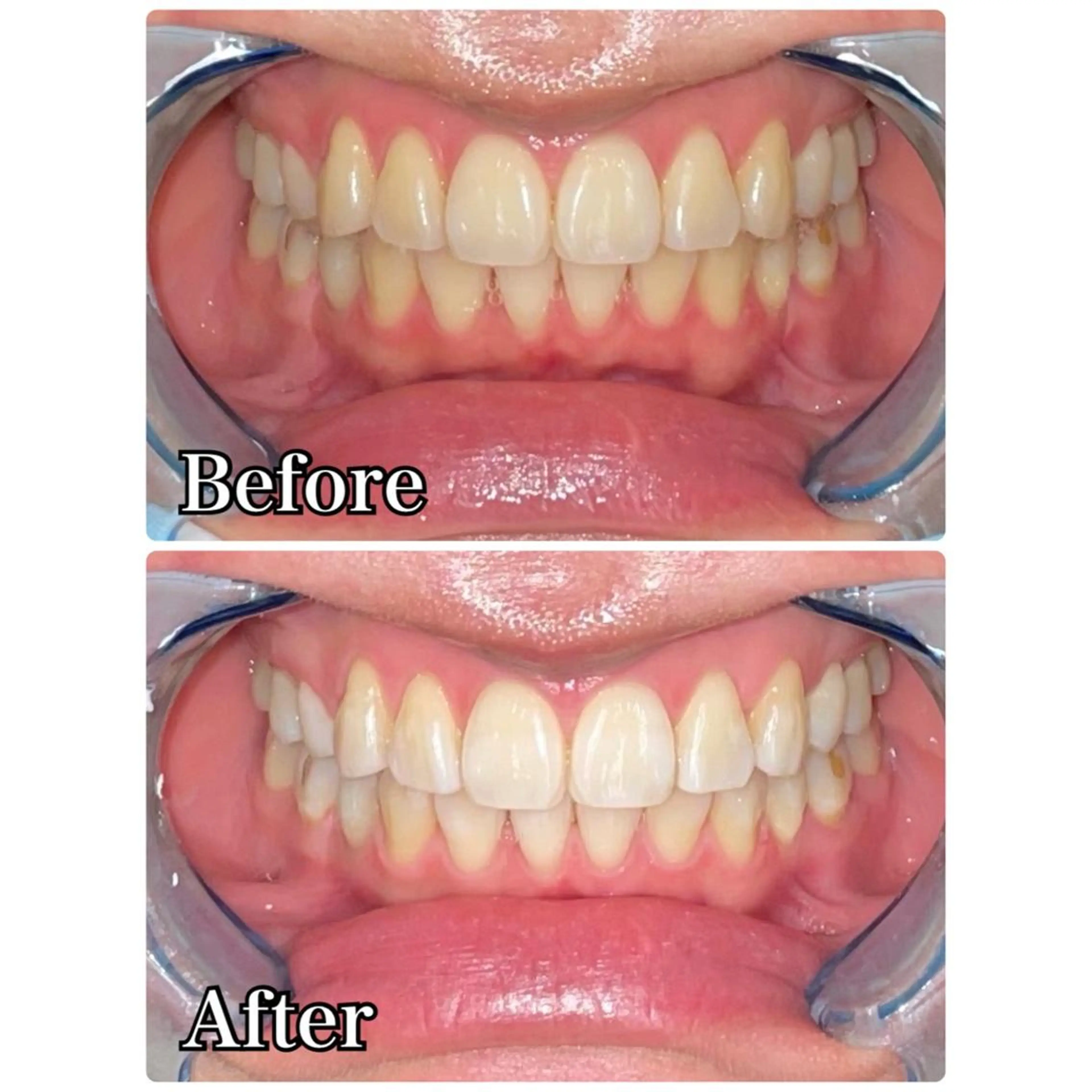 その他 ☆専門店にお任せ☆ ホワイトニング吉祥寺のその他イメージ