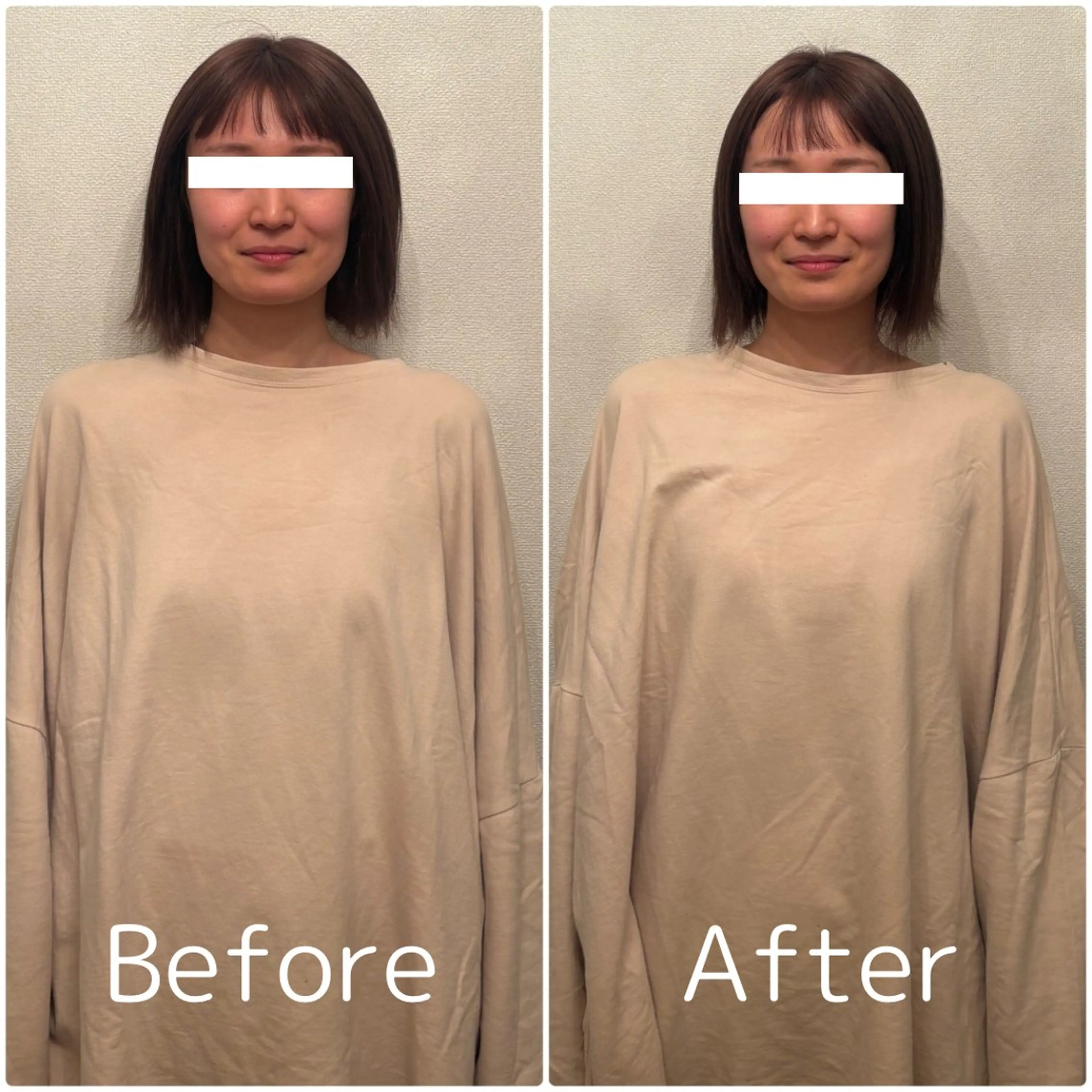 Lily luce 美骨小顔矯正のその他イメージ