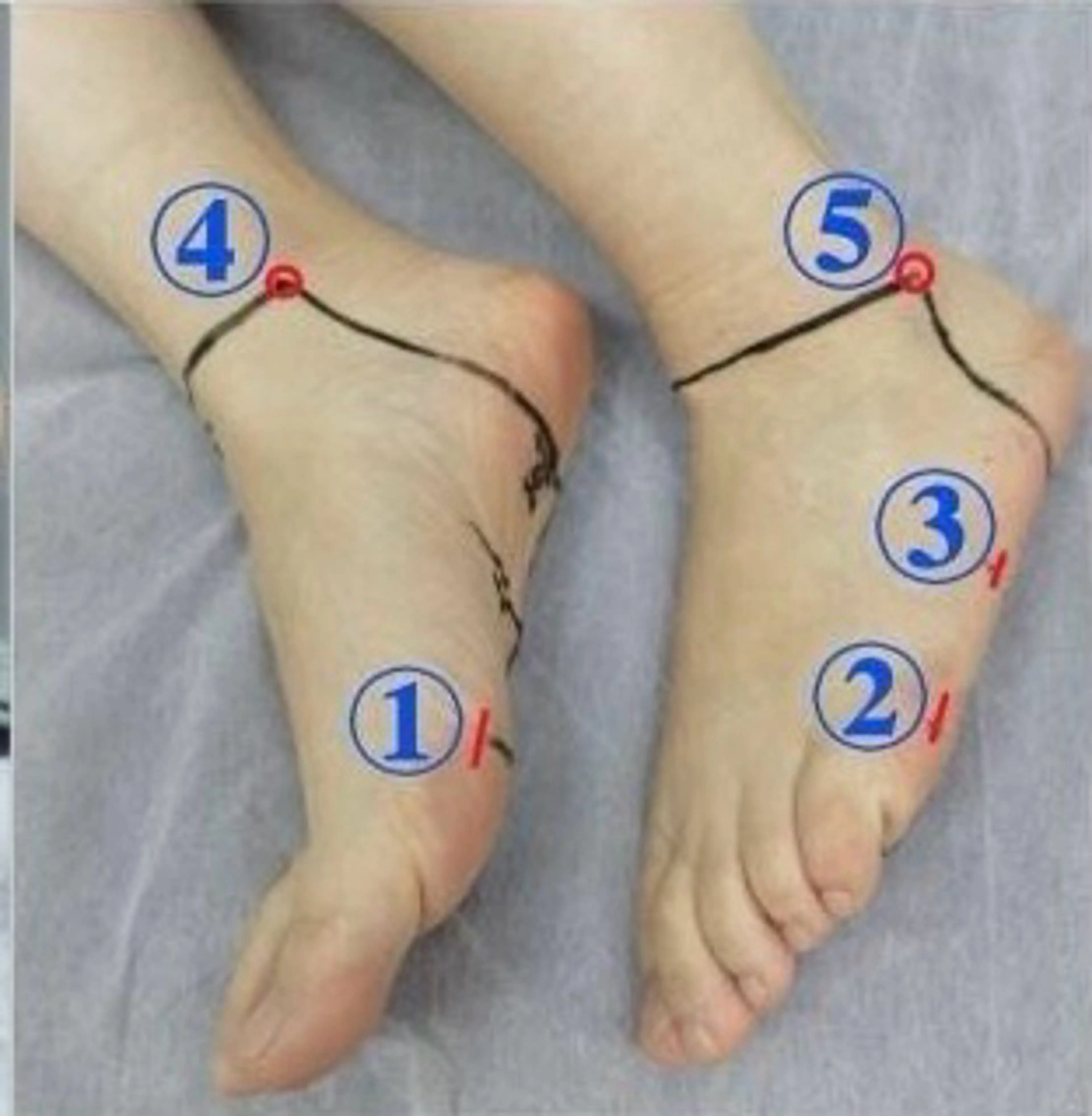 ミニモ限定　足ツボ押し30分　=> 単一不調に集中ケアの写真