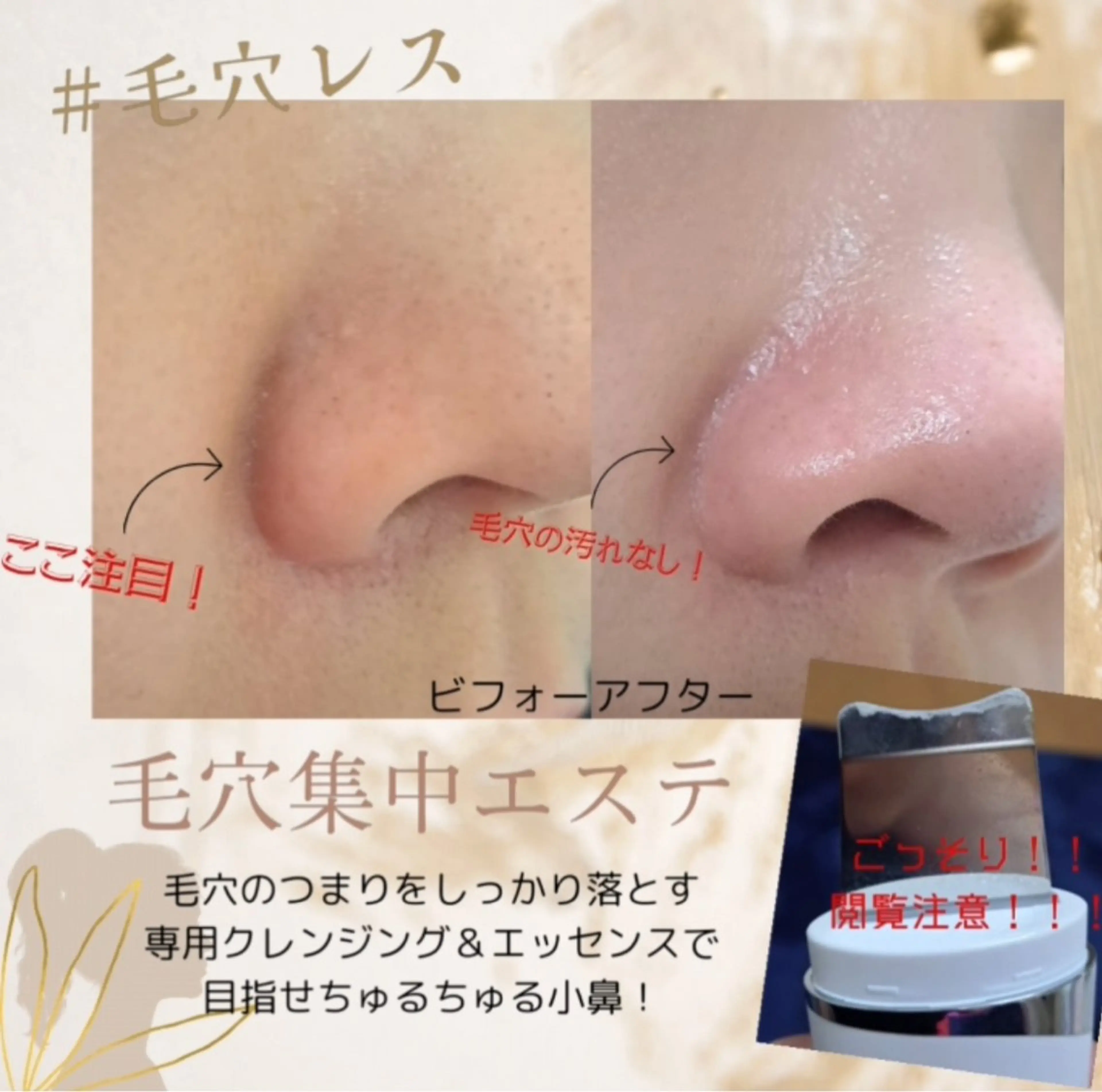 小鼻集中エステの写真