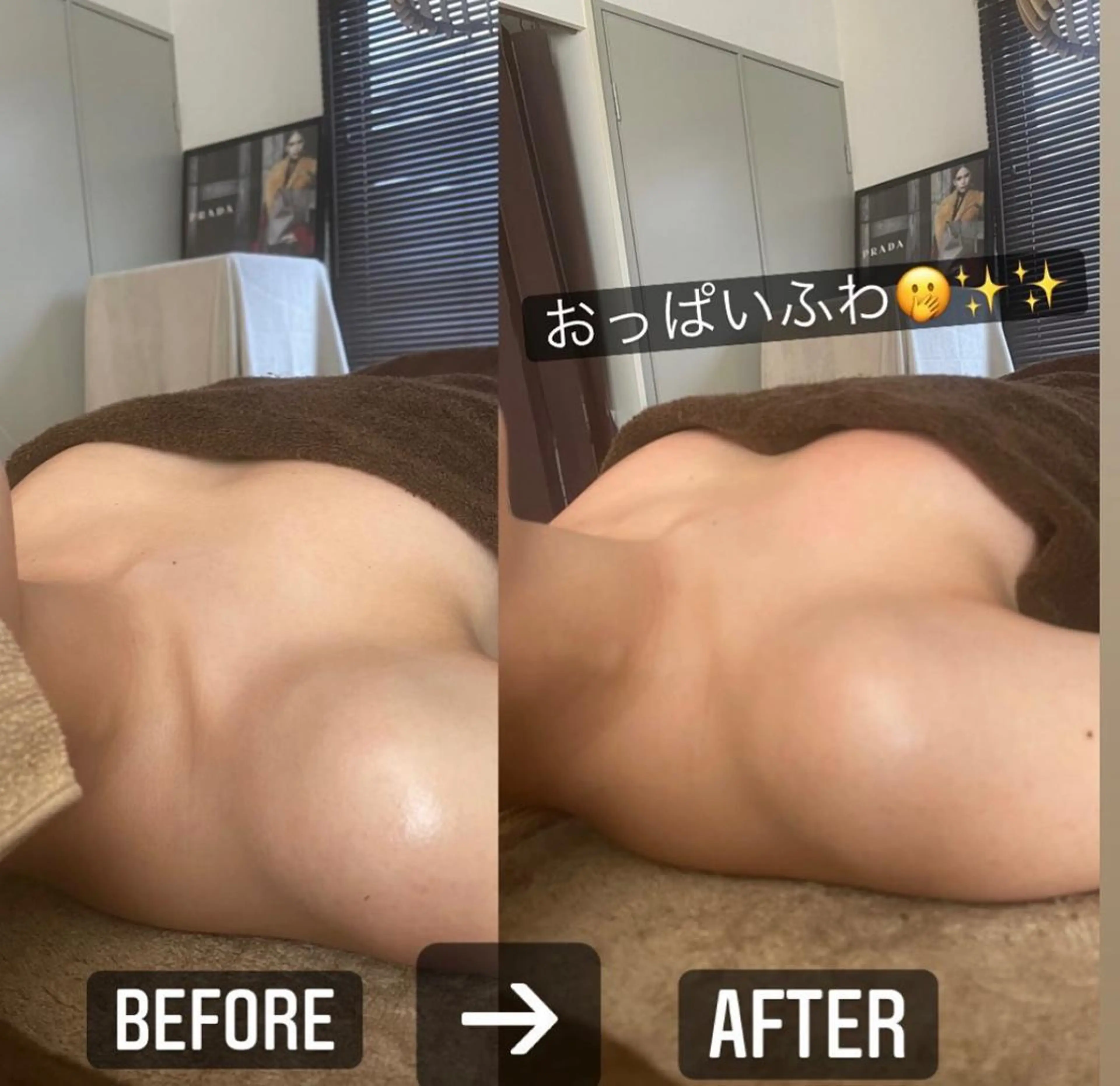 バザルトストーンスペシャル小顔コース(ハイパーナイフ10分付き)の写真